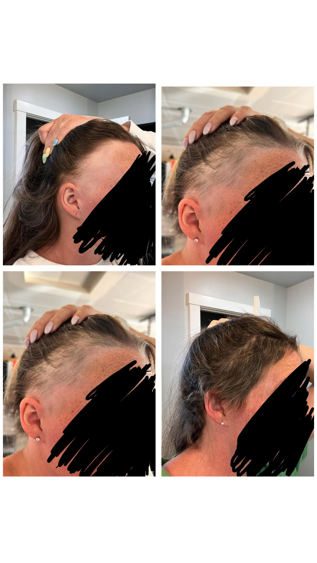 Amina Mitchell Facebook ad: Stop GLP-1 Hair Loss →