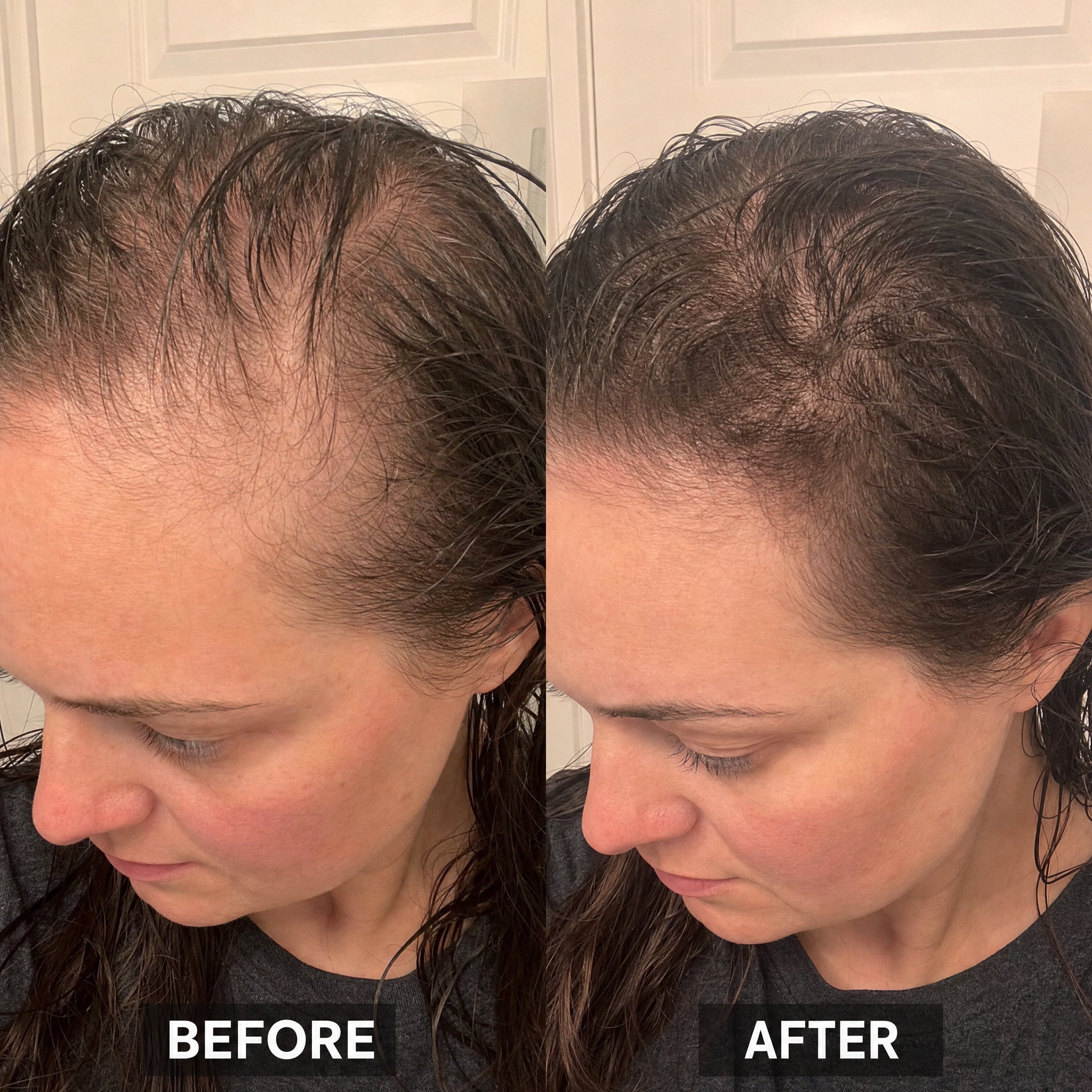 Laura Bennett Facebook ad: Fix Your GLP-1 Hair Loss Today