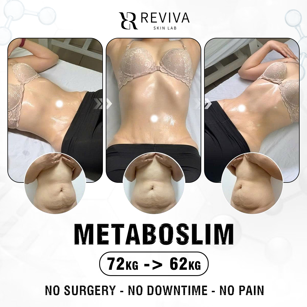Reviva Aesthetic & Beauty Clinic - Iloilo Branch Facebook ad: Discount 35% First 10 Customers Only