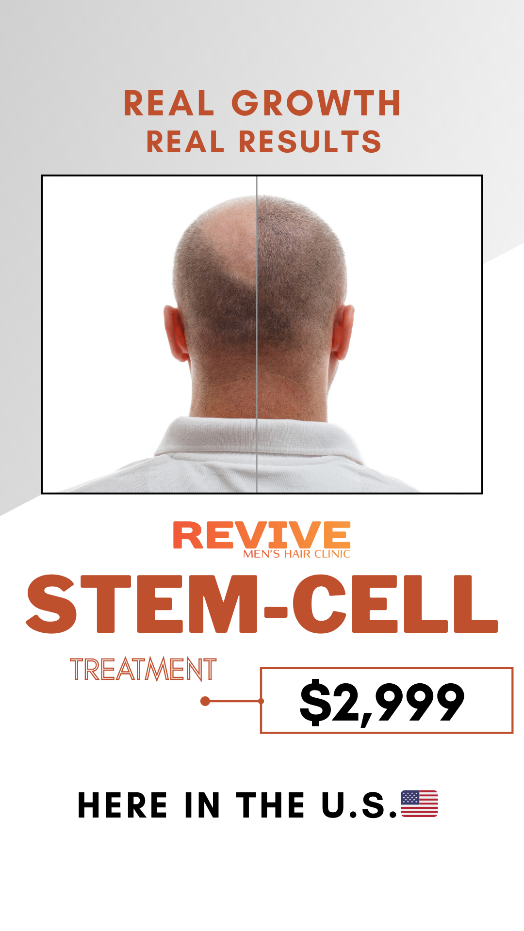 Revive Men's Hair Clinic Facebook ad