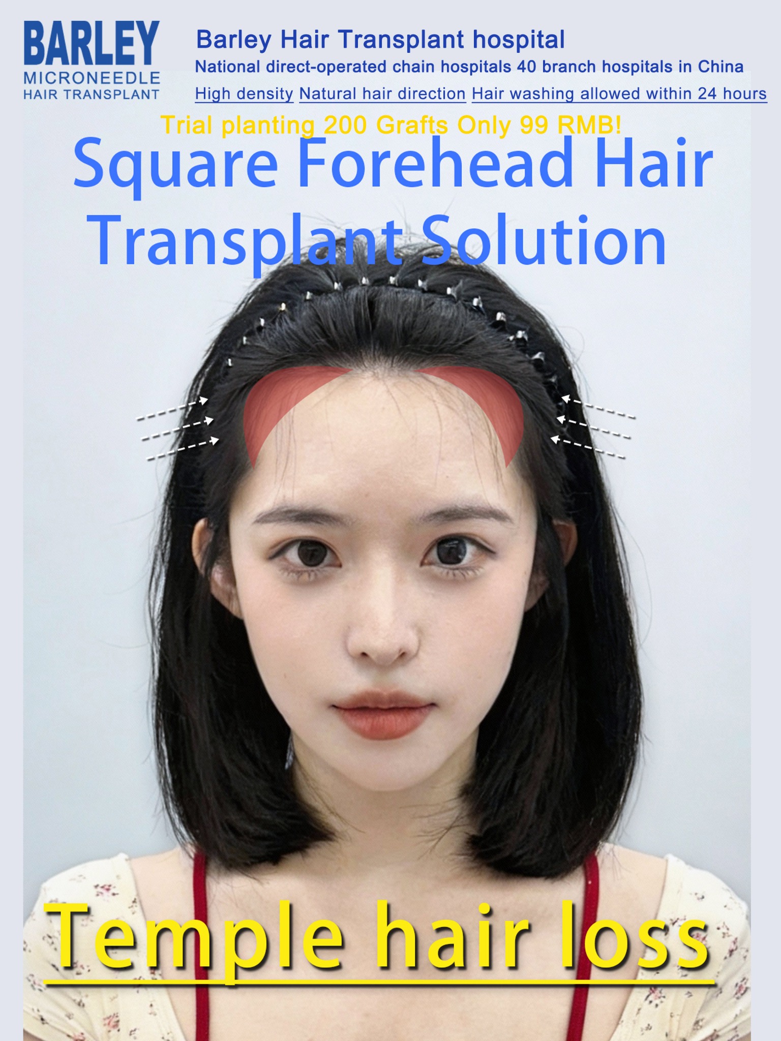Barley Hair Transplant Facebook ad