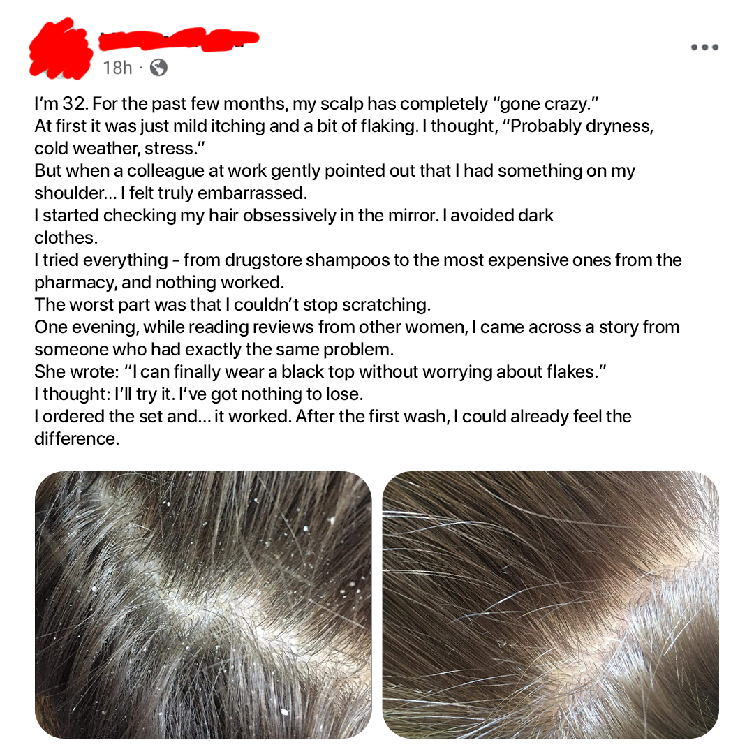 Dermz Laboratories Facebook ad