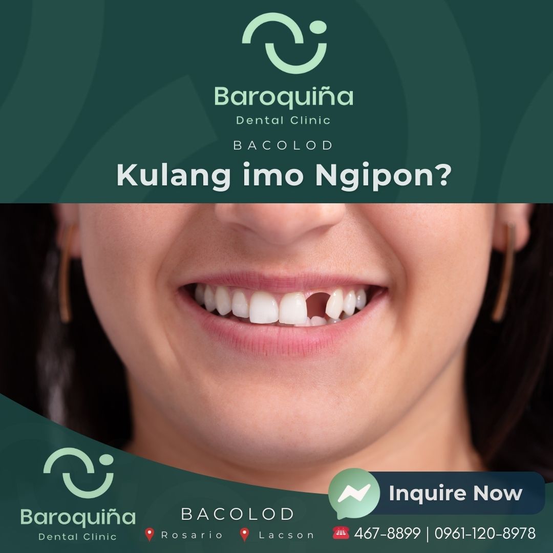 Baroquiña Dental Clinic Facebook ad: Where Confident Smiles Begin