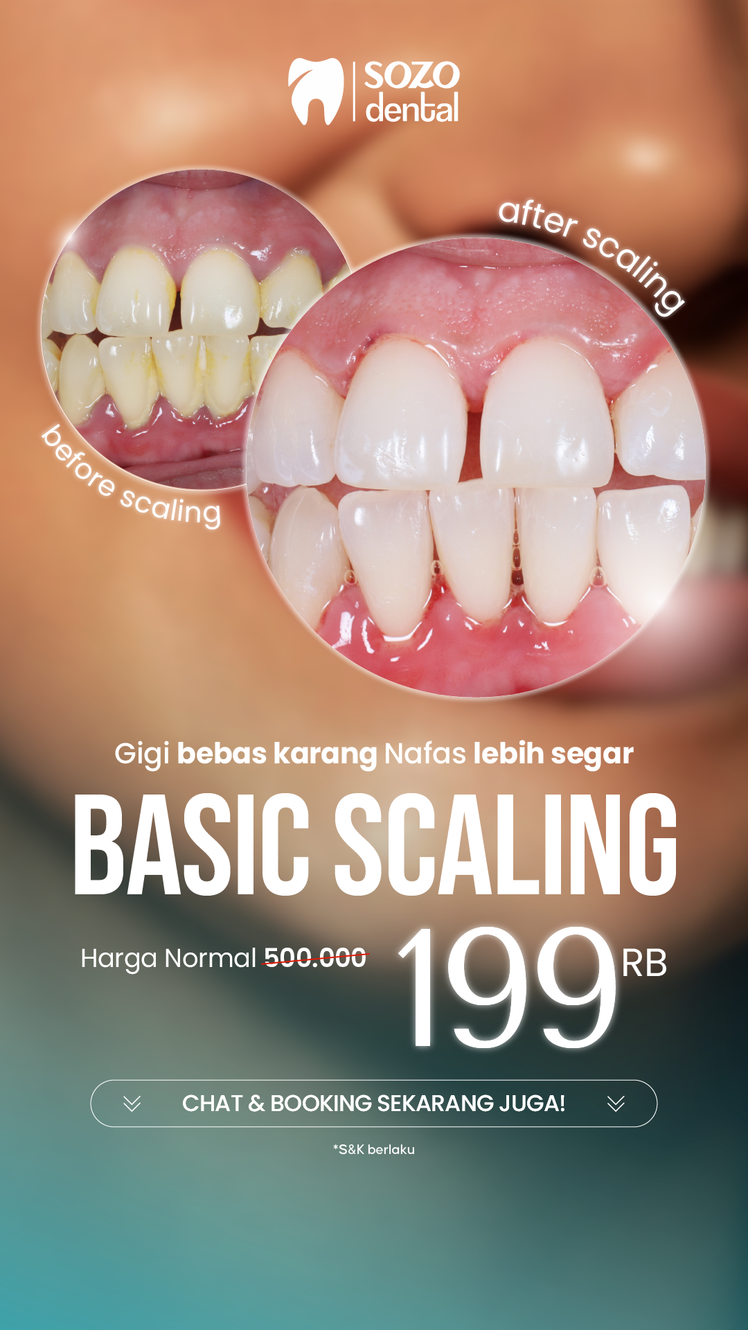 Sozo Dental Clinic Facebook ad