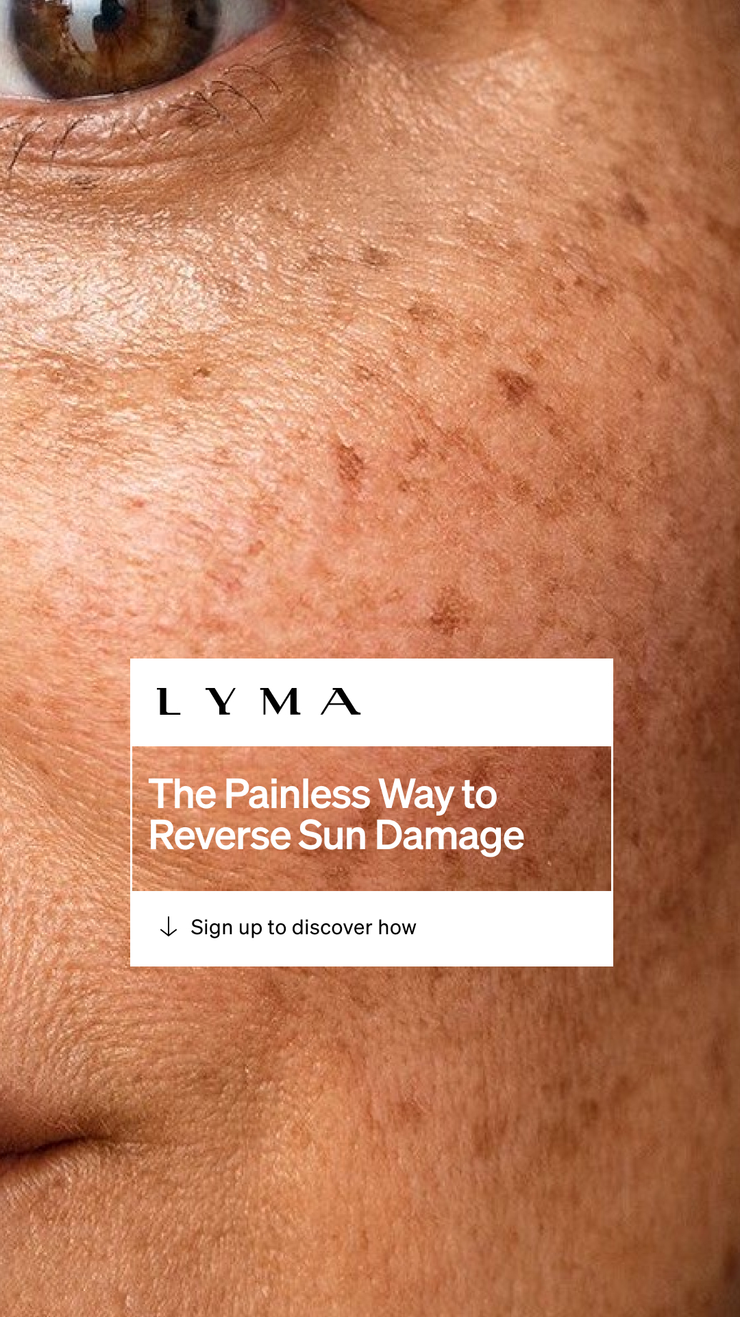 LYMA Facebook ad