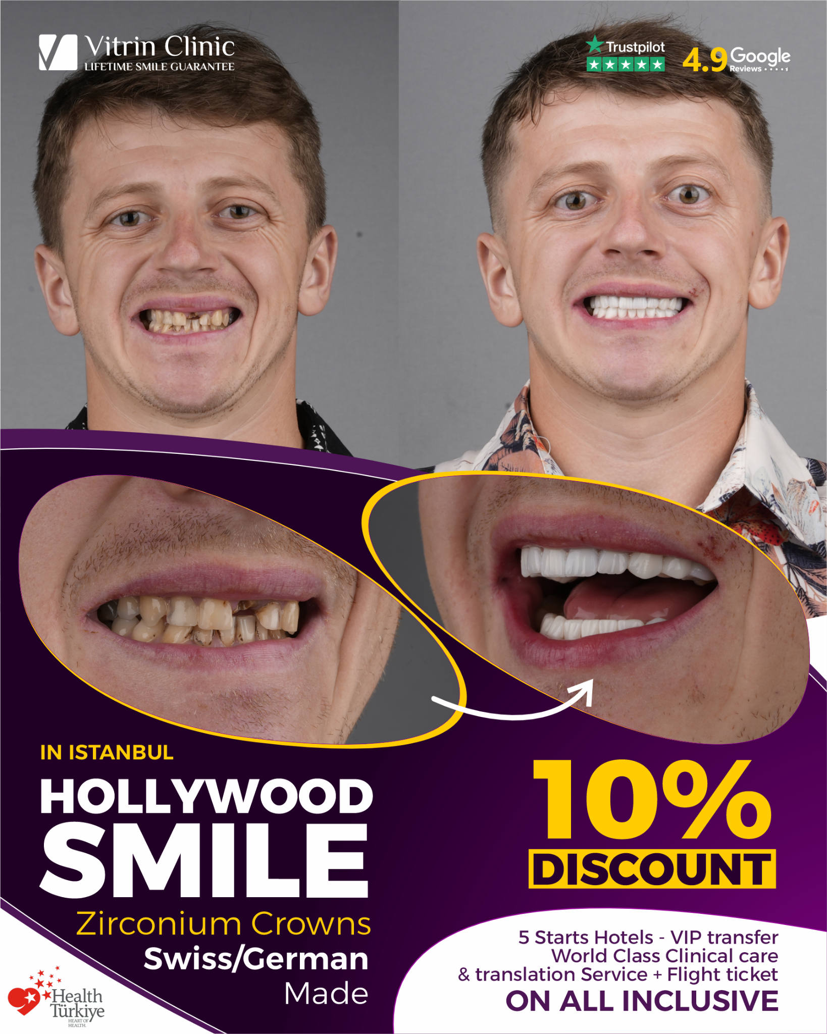 Vitrin Dental Clinic Facebook ad