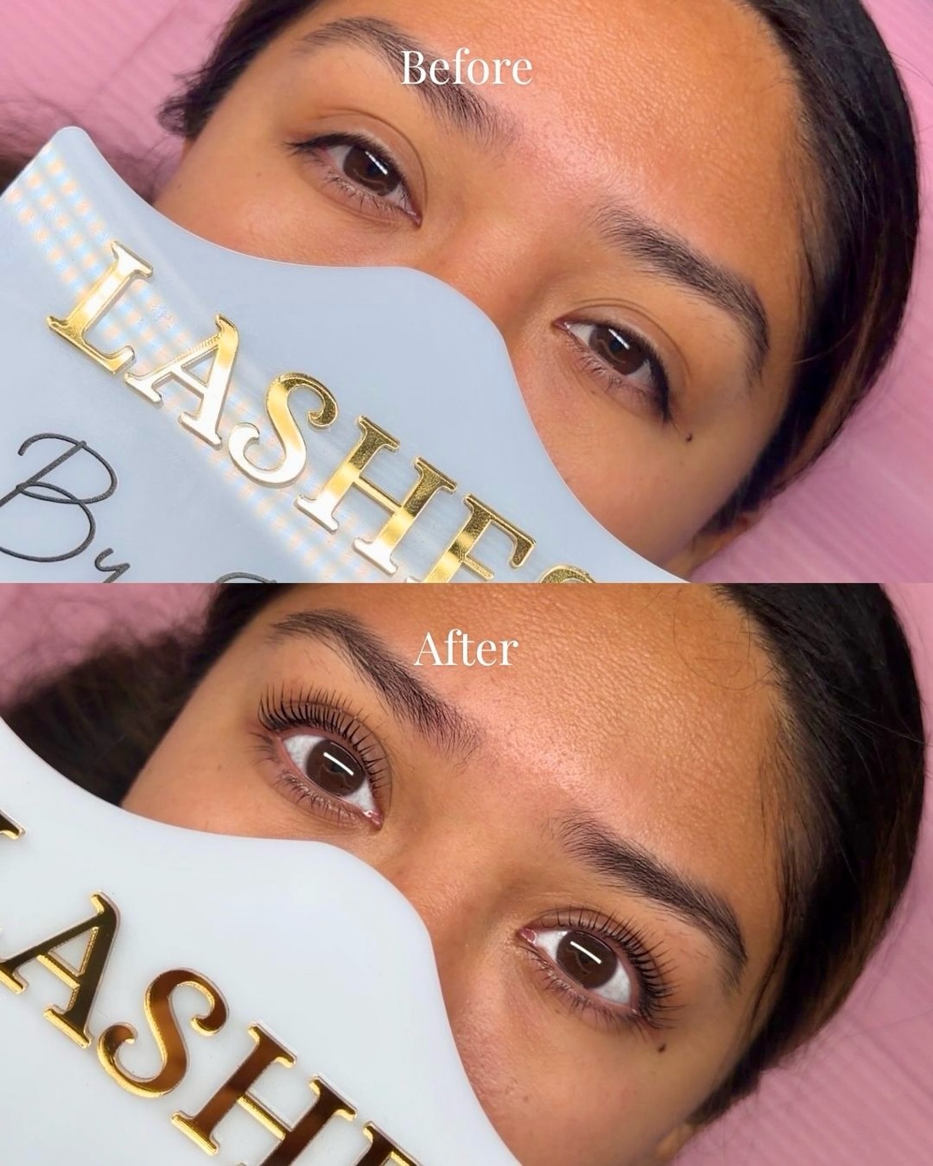 Anaslife Facebook ad: BEFORE AFTER
