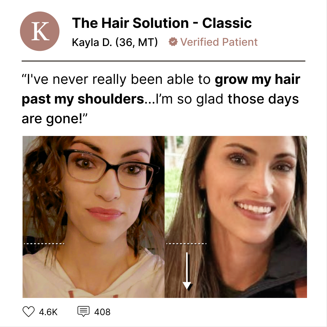 Musely Facebook ad