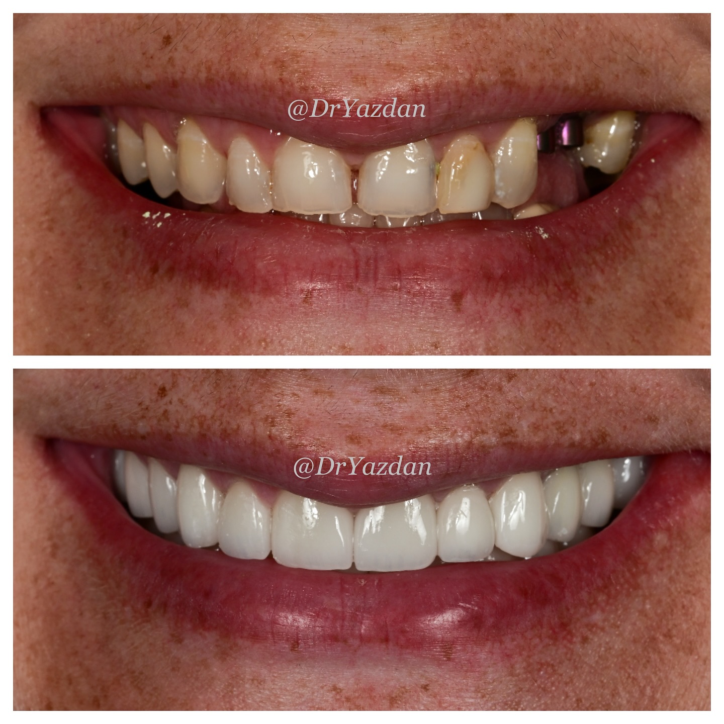 Dr. Desiree Yazdan (Dentist) Facebook ad