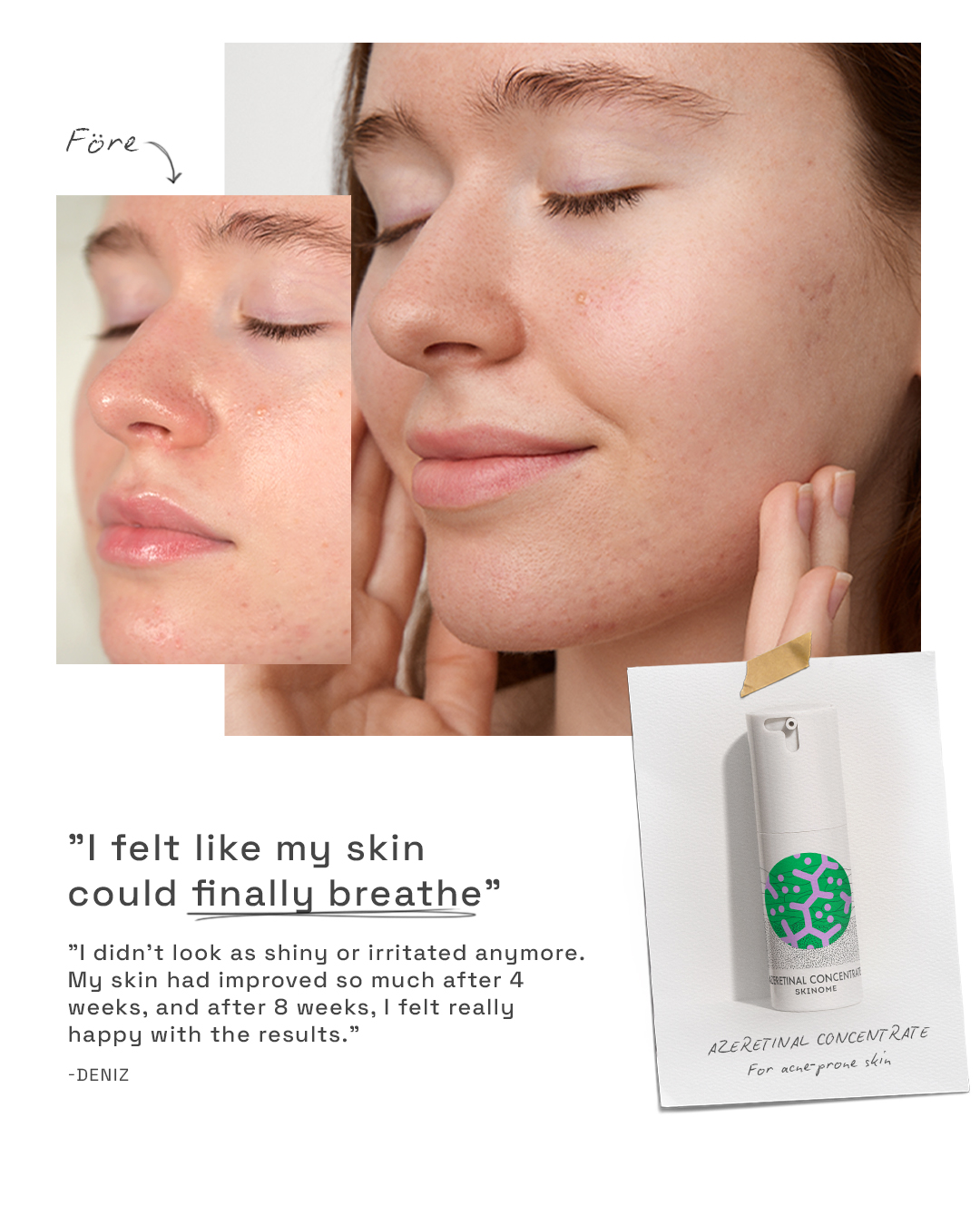 Skinome Facebook ad