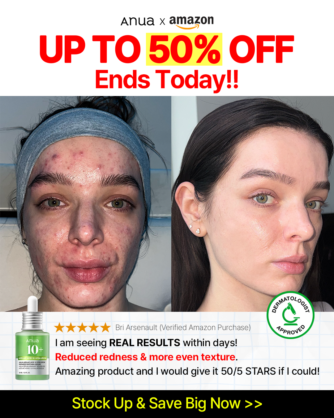 ANUA_Global Facebook ad