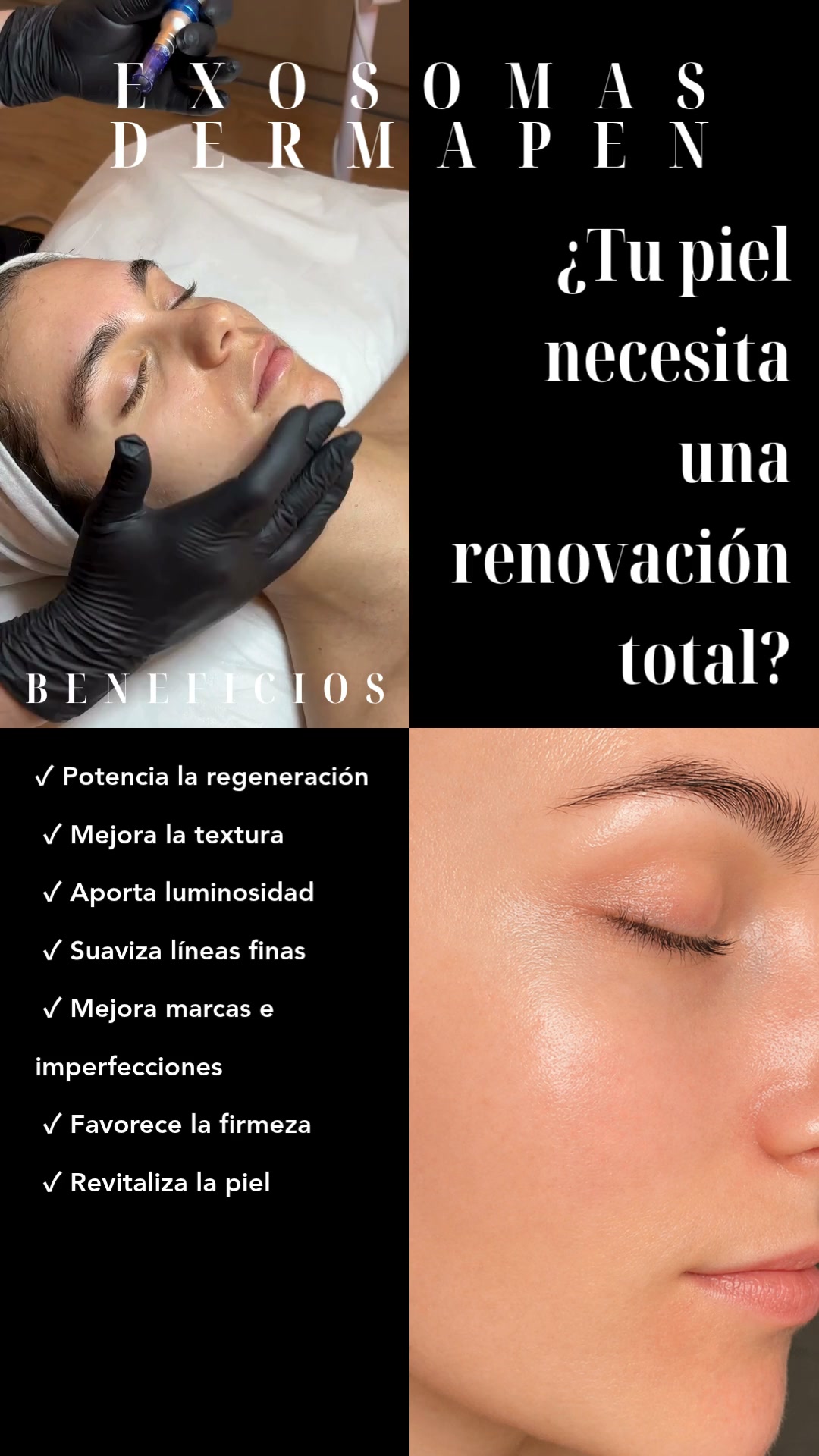Beldon Beauty Facebook ad: Regeneración que se nota