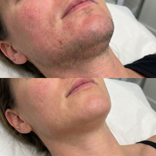 Dr. Hannah Jacob Facebook ad