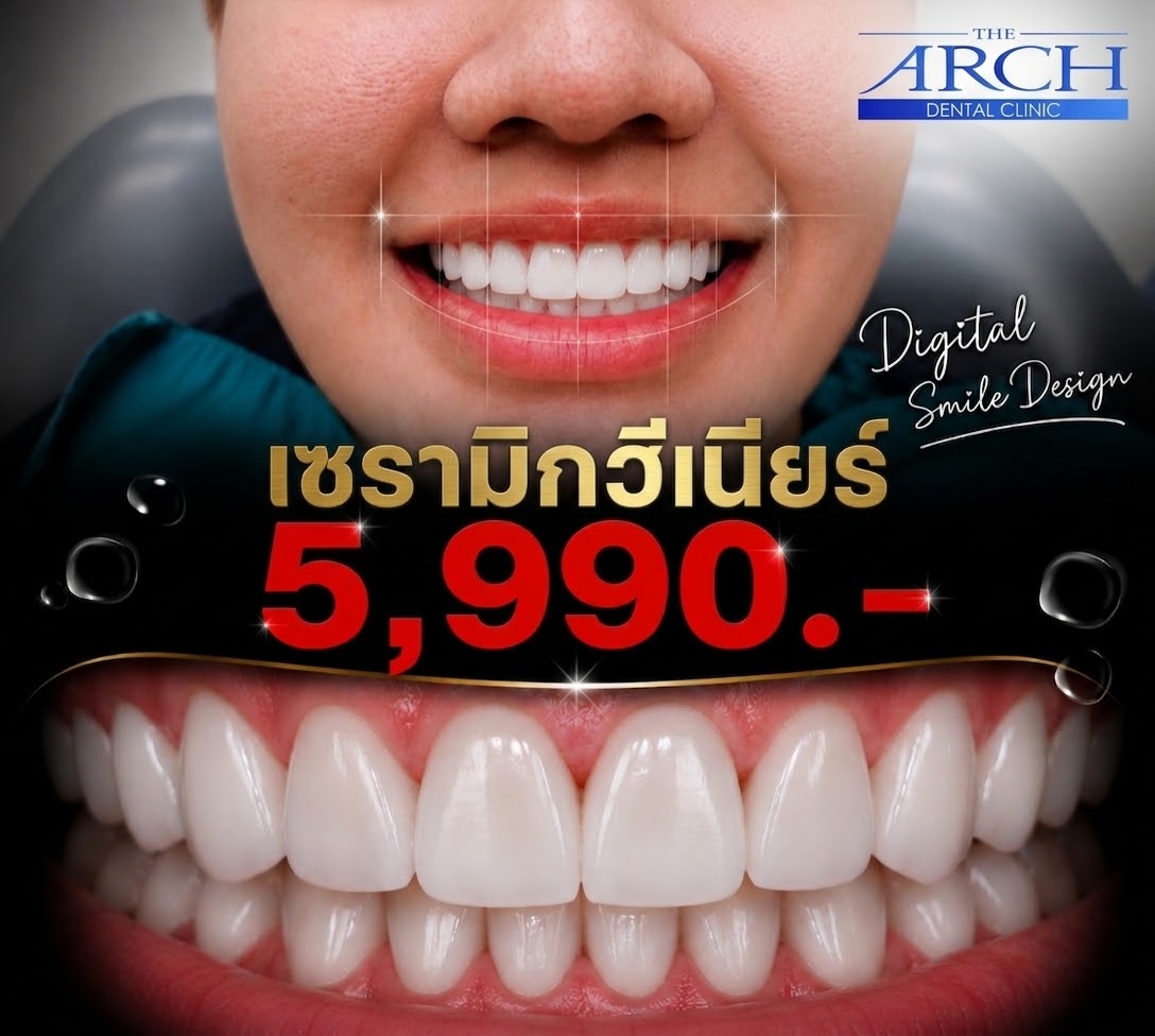 The ARCH คลินิกทันตกรรม สาขาอโศก จัดฟันใส วีเนียร์ รากฟันเทียม ฟอกสีฟัน Facebook ad: เซรามิกวีเนียร์ 5,990.- ไม่ต้องคิดเยอะ จองเลย!