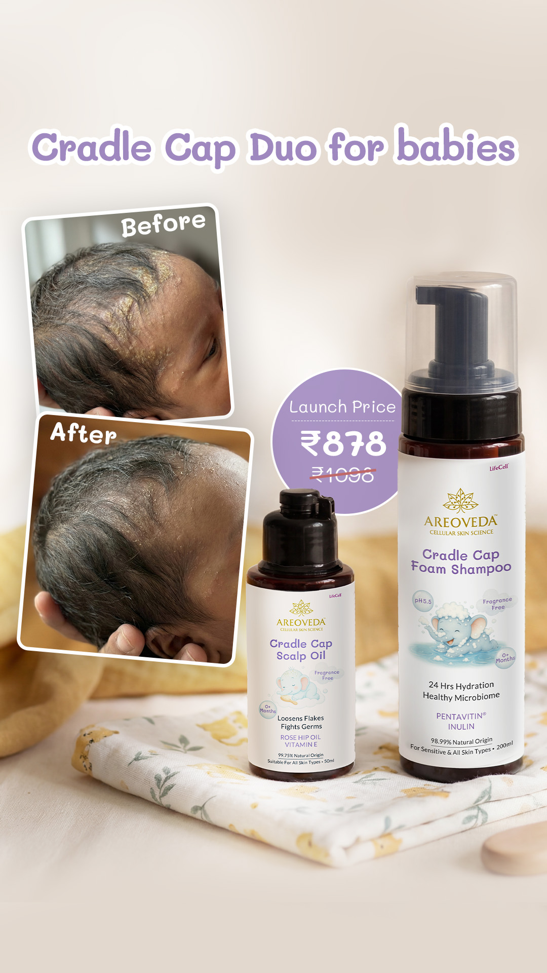AreoVeda Facebook ad