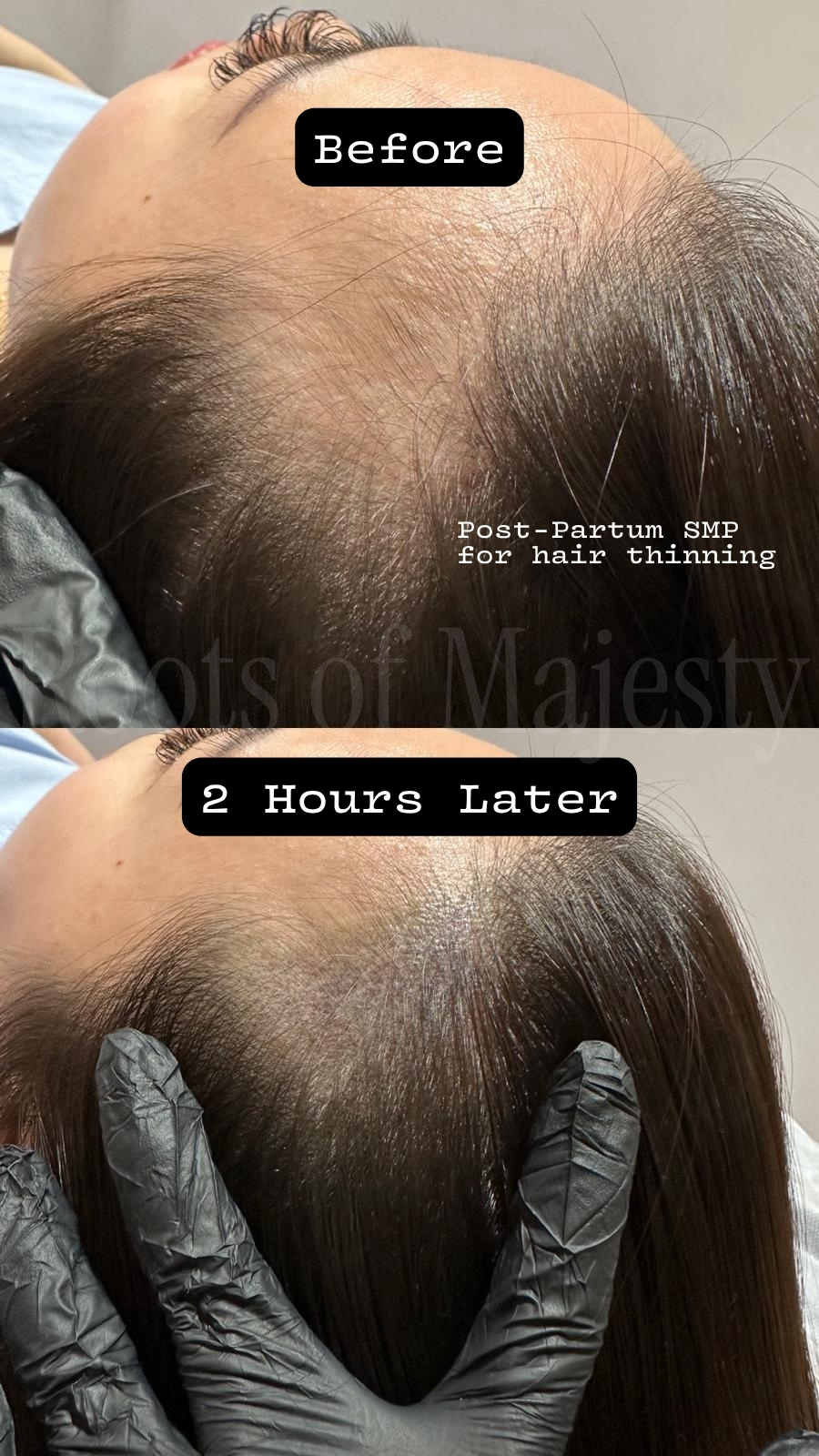 Roots of Majesty Facebook ad: Postpartum hair loss is real, and it’s more…
