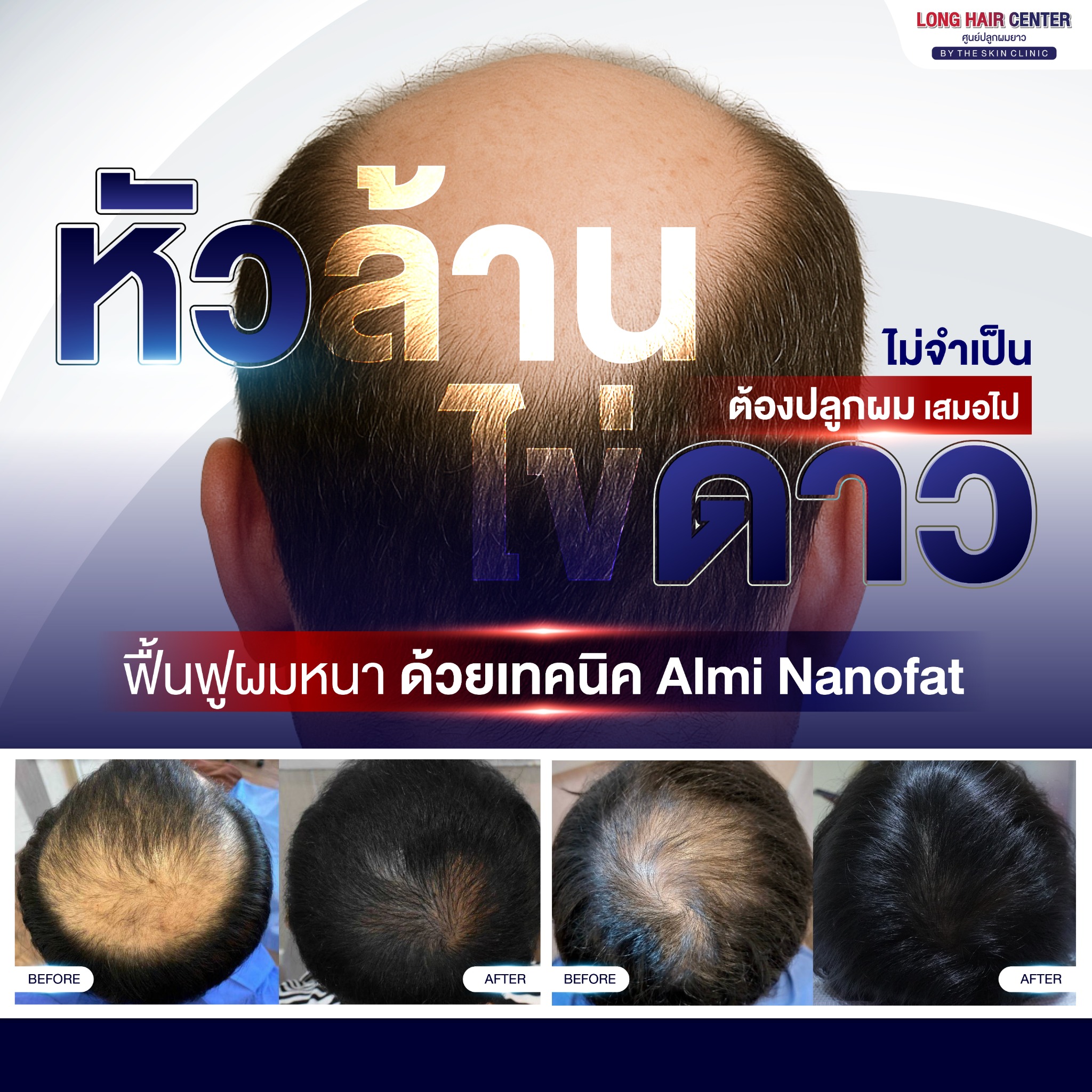 หมอท็อป ปลูกผม The skin clinic แพทย์อเมริกันบอร์ด - International Speaker Facebook ad from Oct 9, 2025
