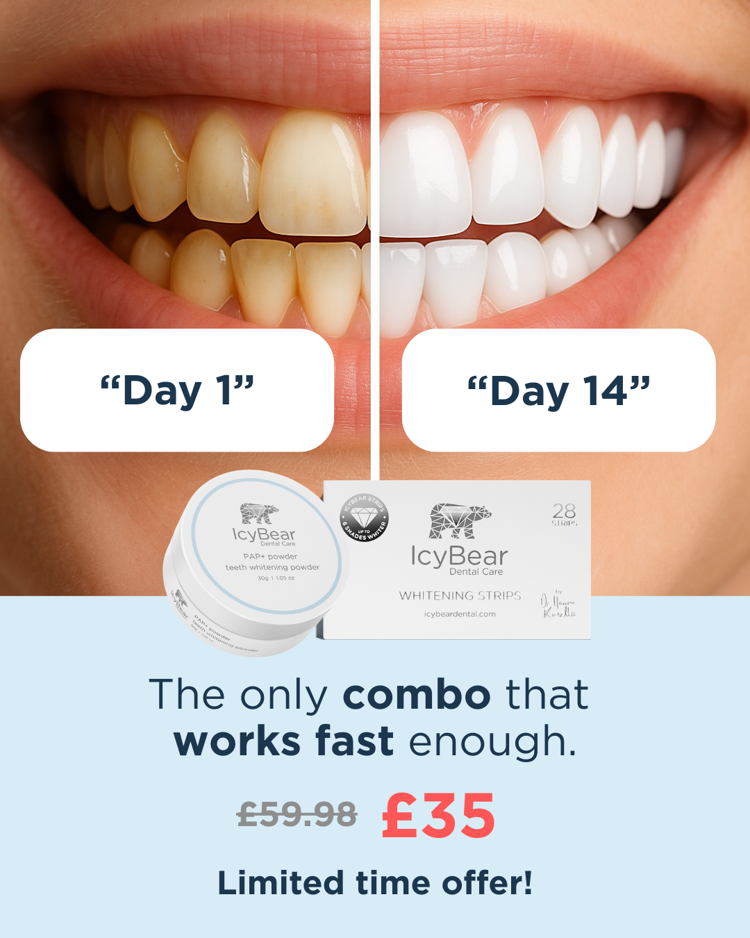 Icy Bear Dental Facebook ad
