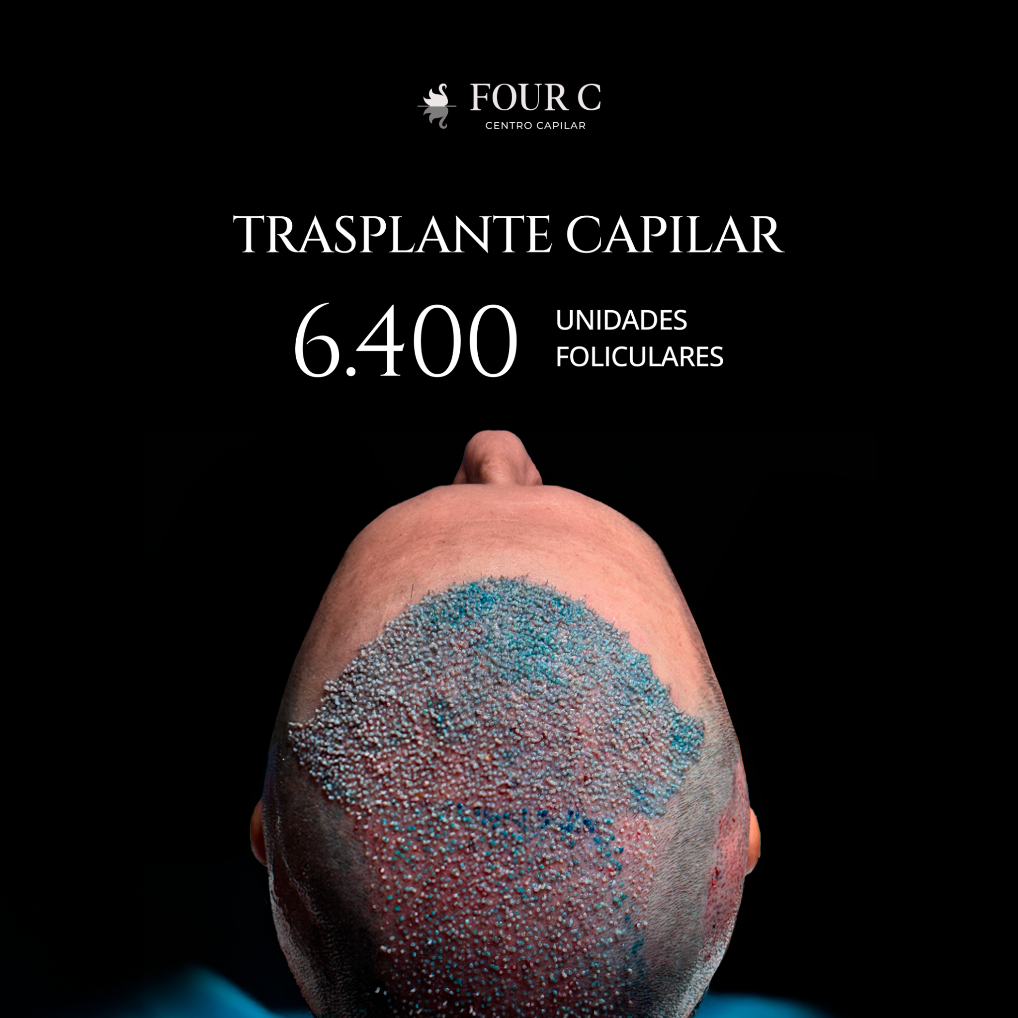 FOUR C Centro Capilar Facebook ad from Jan 21, 2026