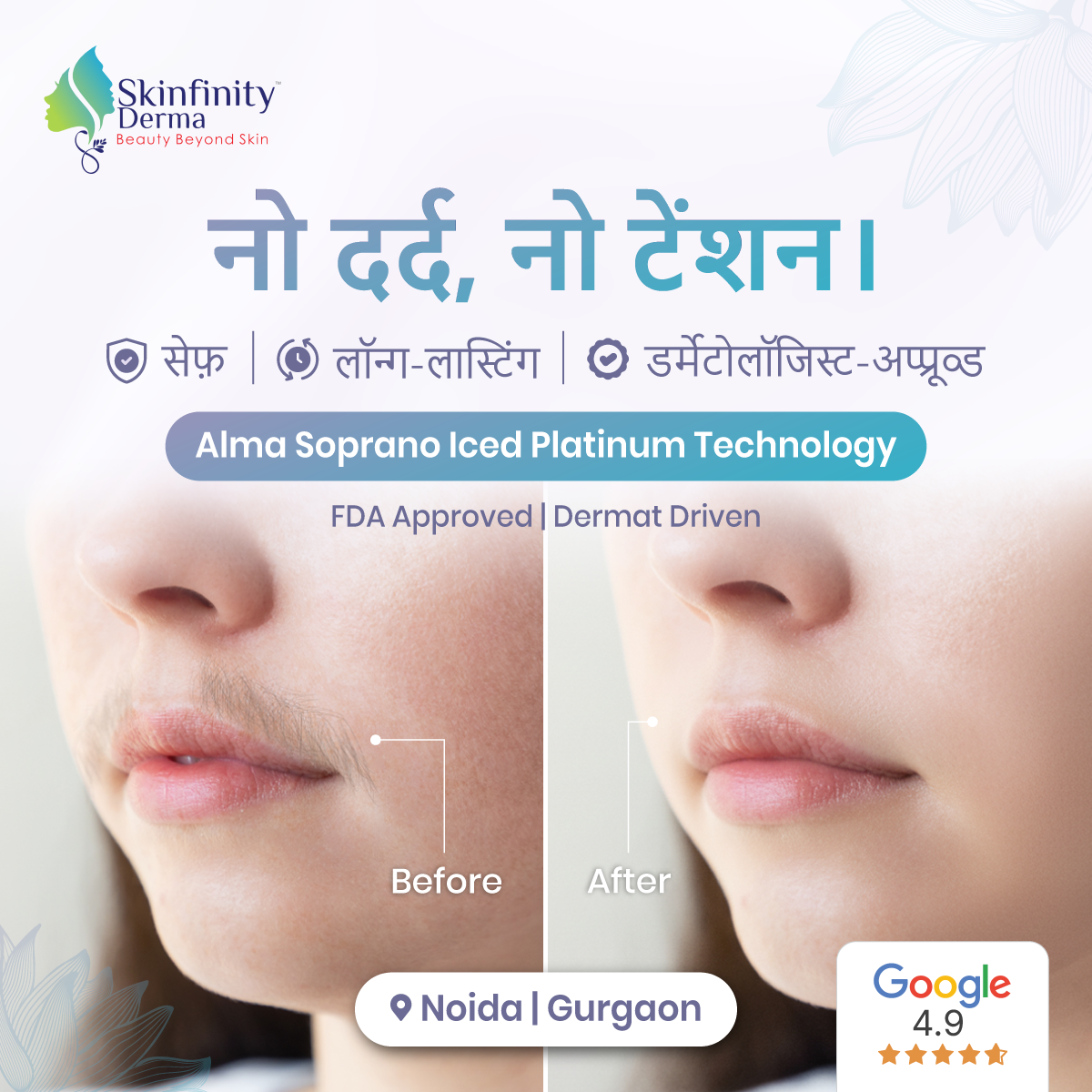 Skinfinity Derma Skin, Hair and Laser clinic Facebook ad