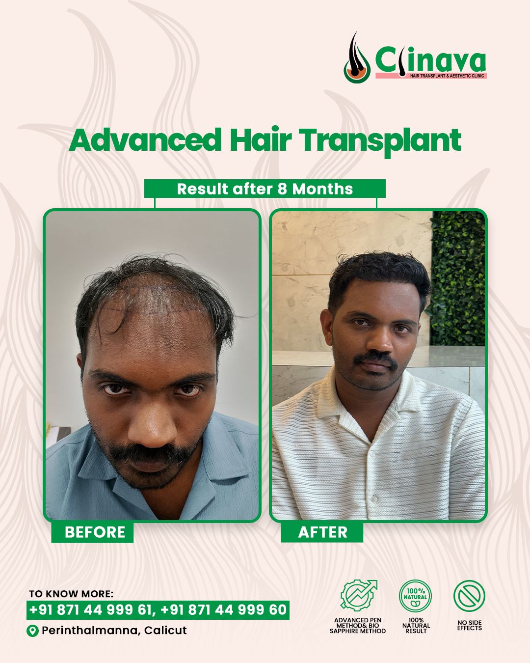 Clinava Hair Transplant & Aesthetic Clinic Facebook ad