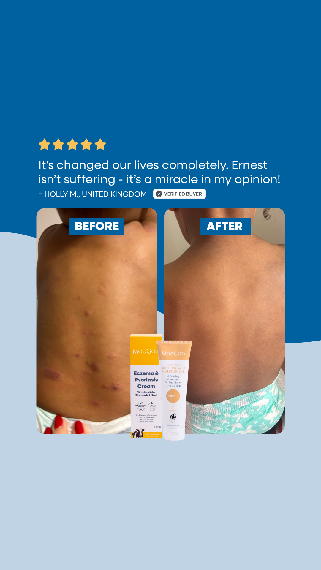 MooGoo Skin Care Facebook ad