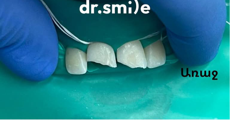 Dr. smile Facebook ad