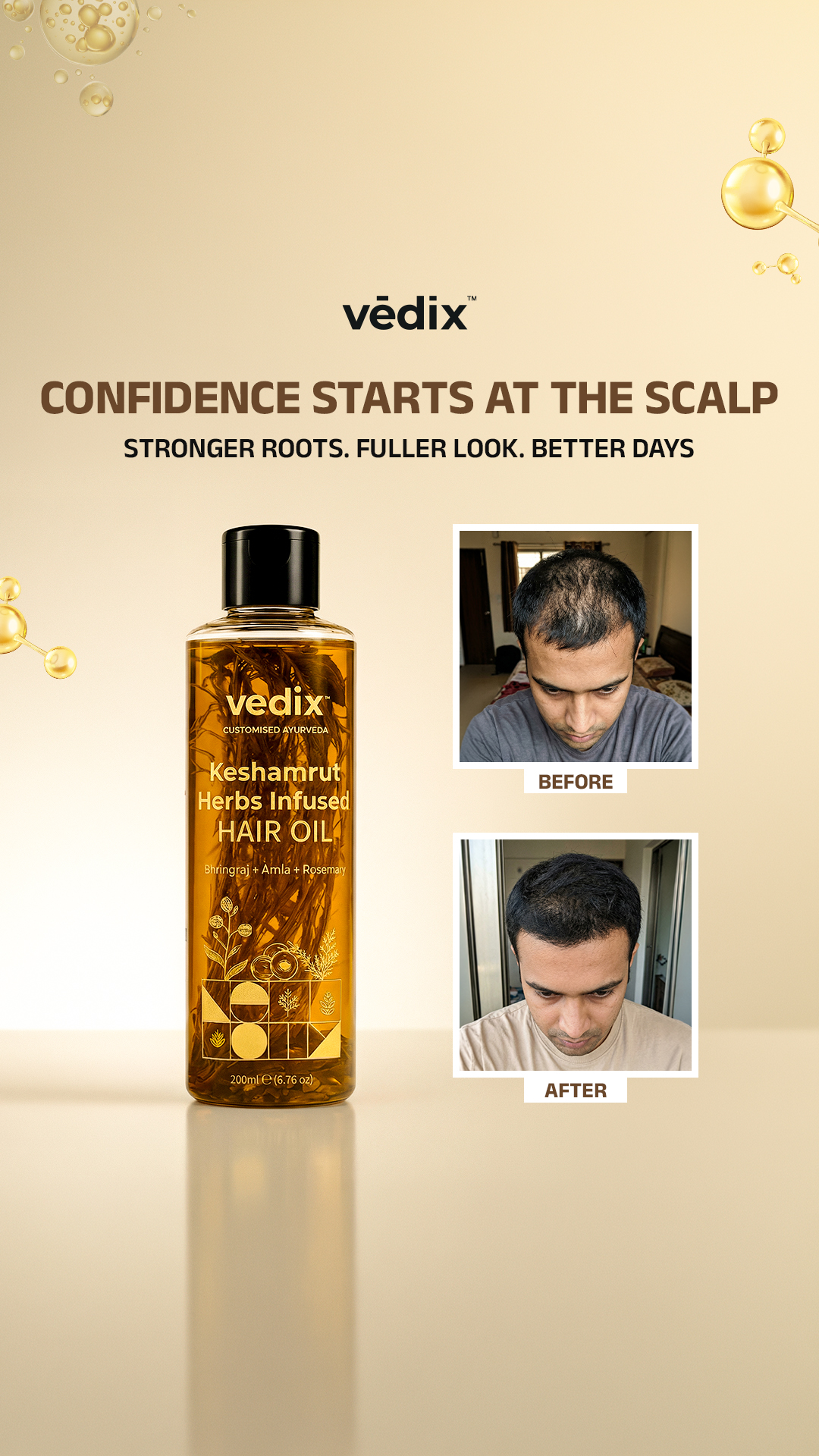 Vedix Facebook ad