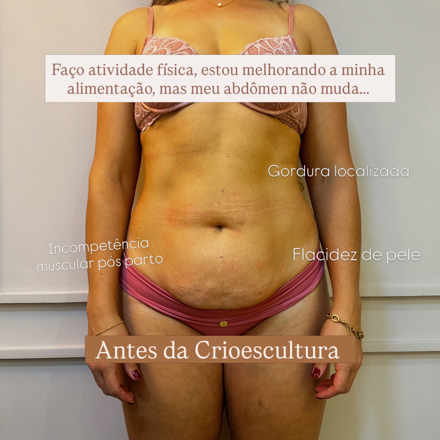 JT Clinic Facebook ad: Diferente de tudo que tínhamos até aqui a…
