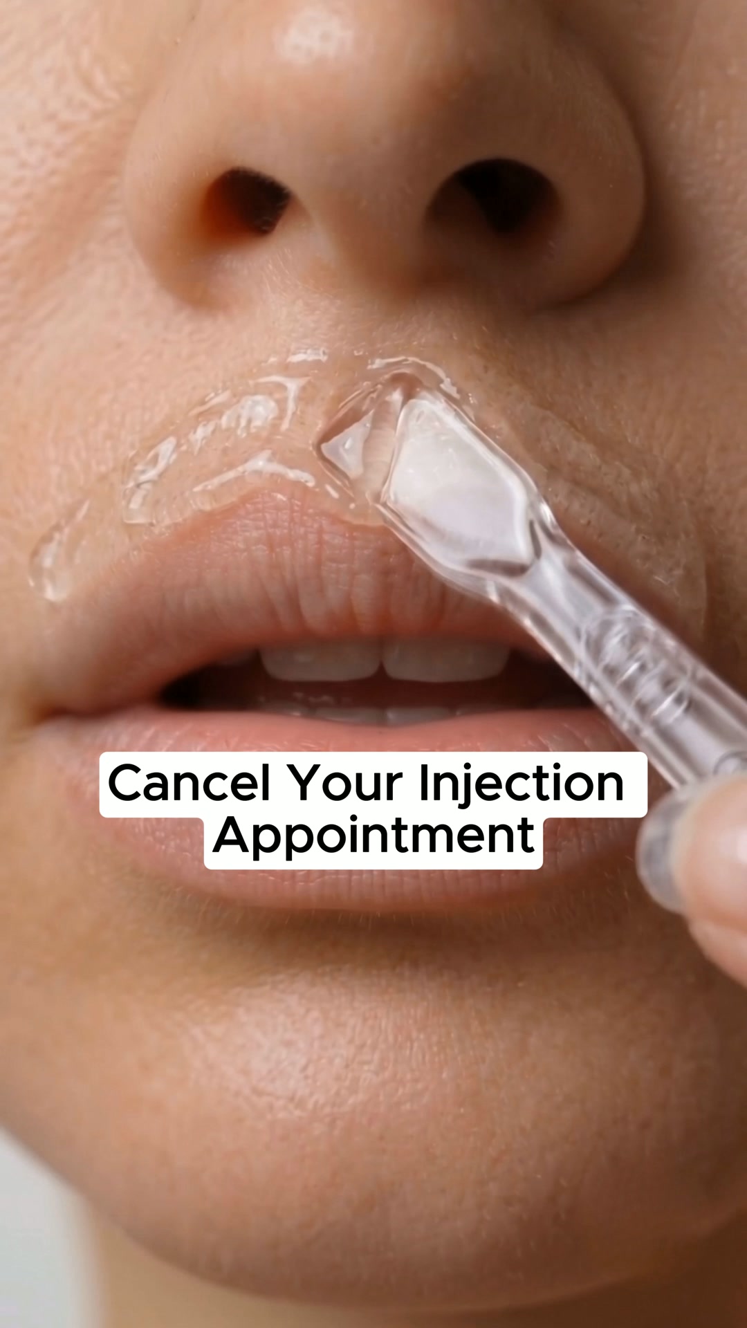 City Beauty Facebook ad: Cancel Your Injection Appointment