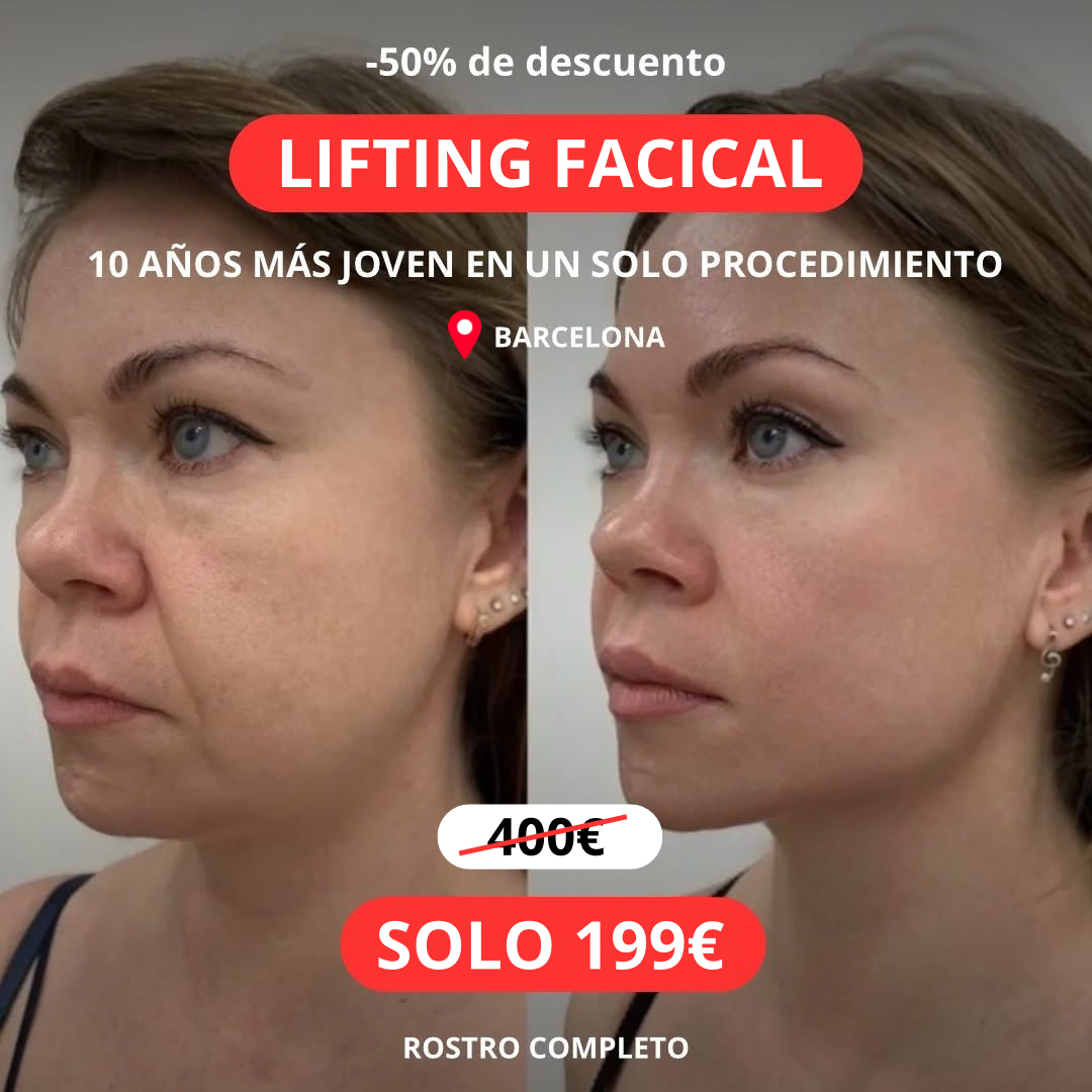 Smas lifting Barcelona Facebook ad: ¿Quieres lucir más joven sin cirugías ni inyecciones…
