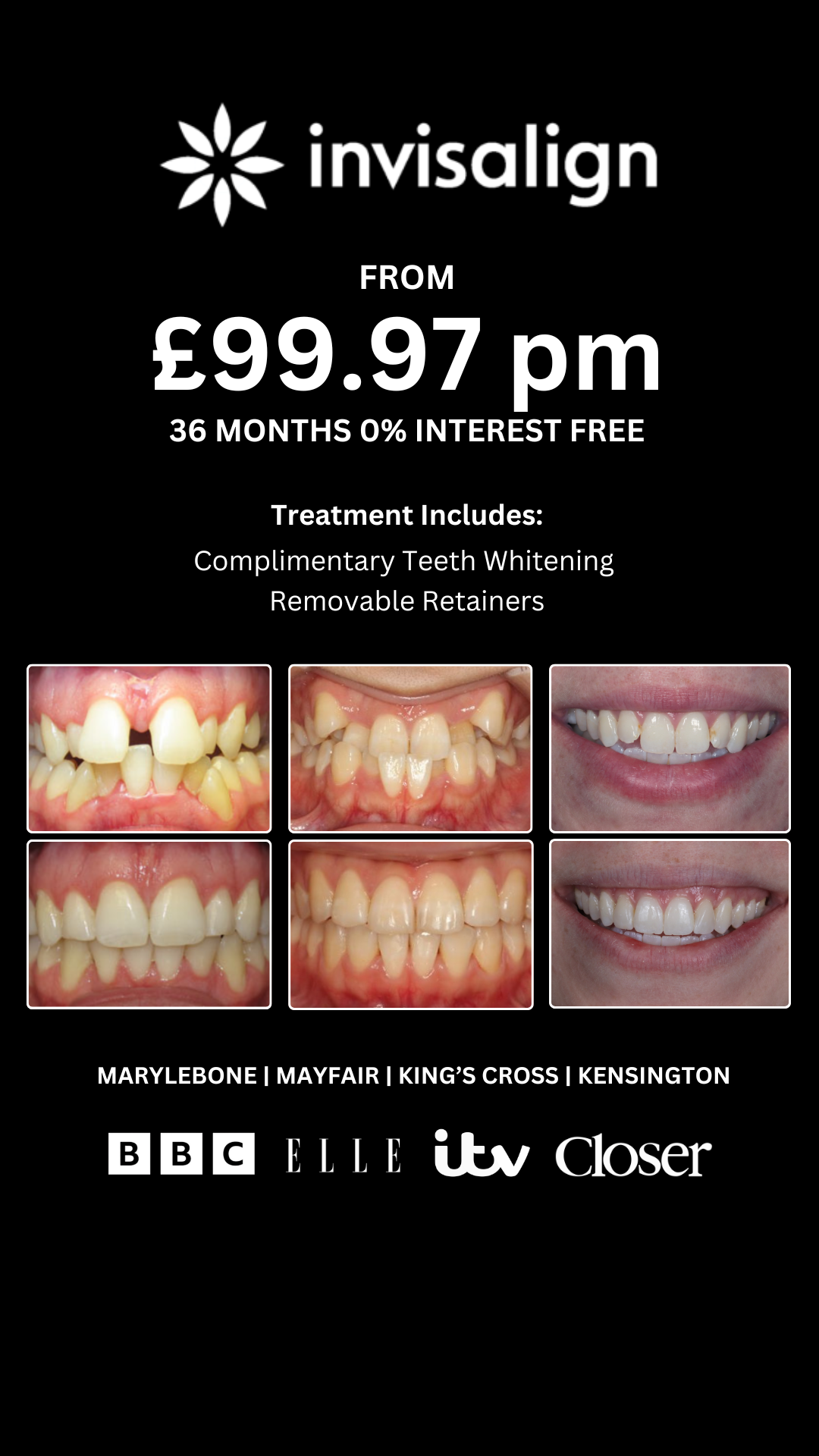 Bond Dental London Facebook ad from Dec 19, 2025
