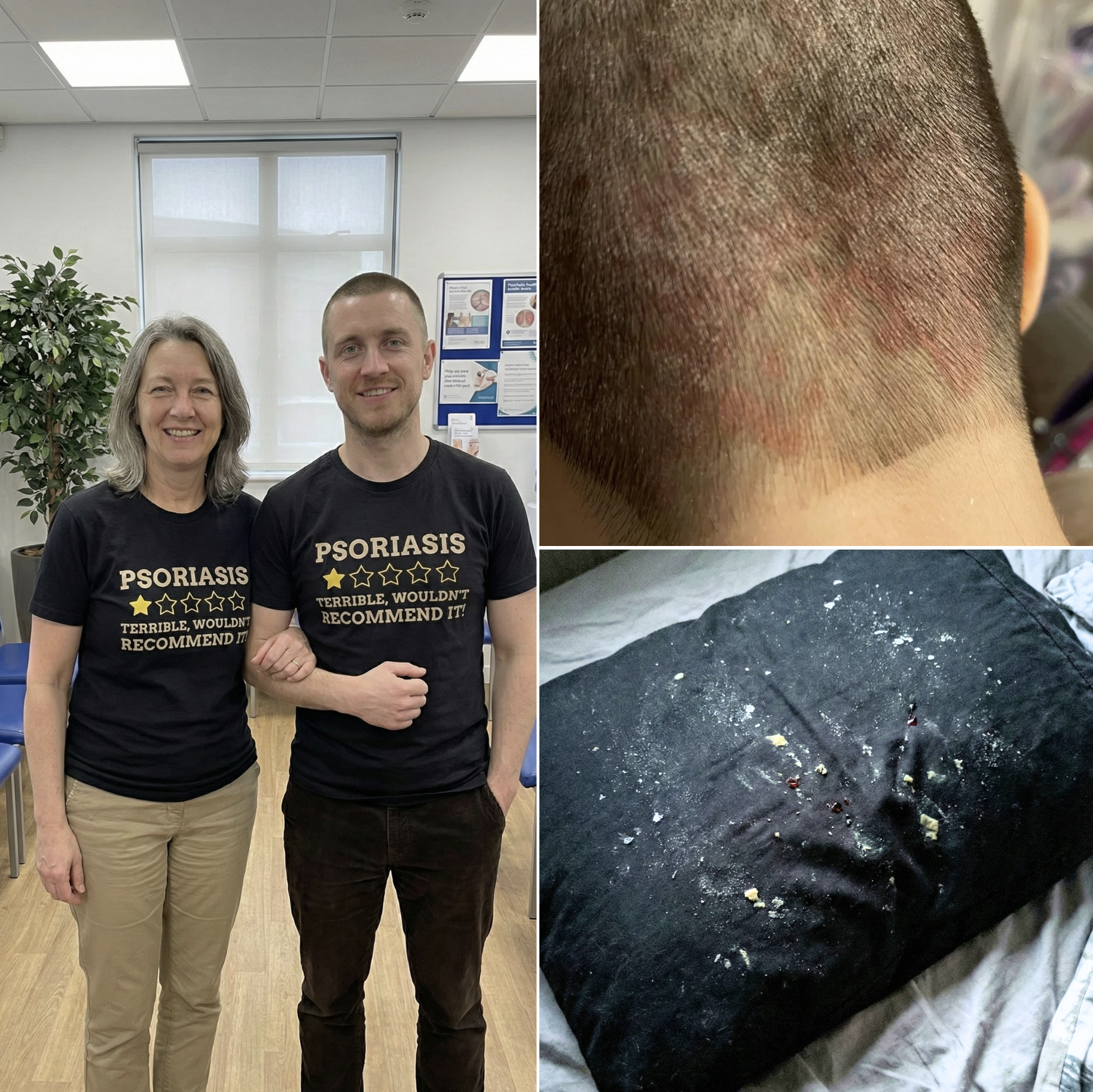 Clara Whitby Facebook ad: How To Clear Scalp Psoriasis in 4 Weeks
