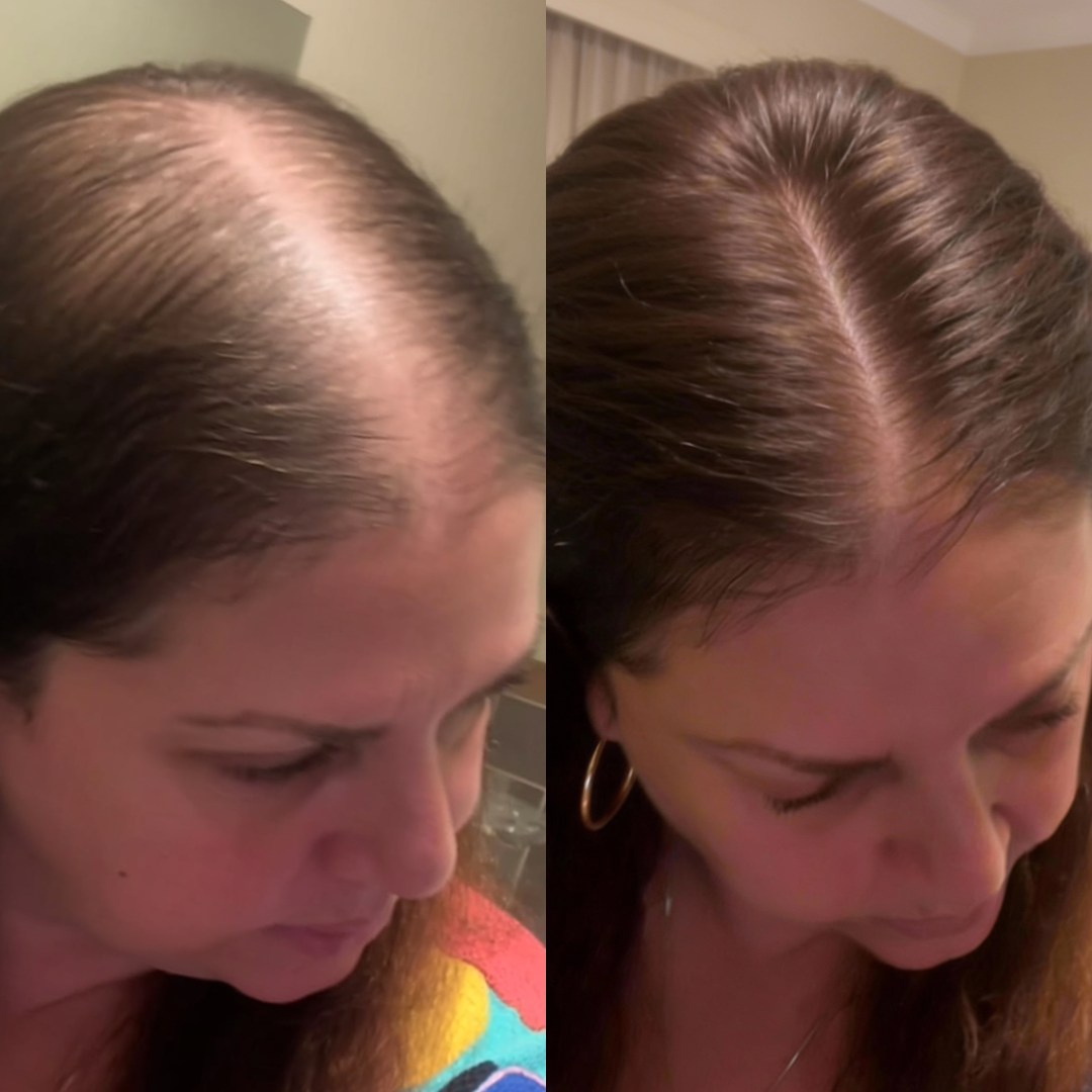 True Hair Forum Facebook ad