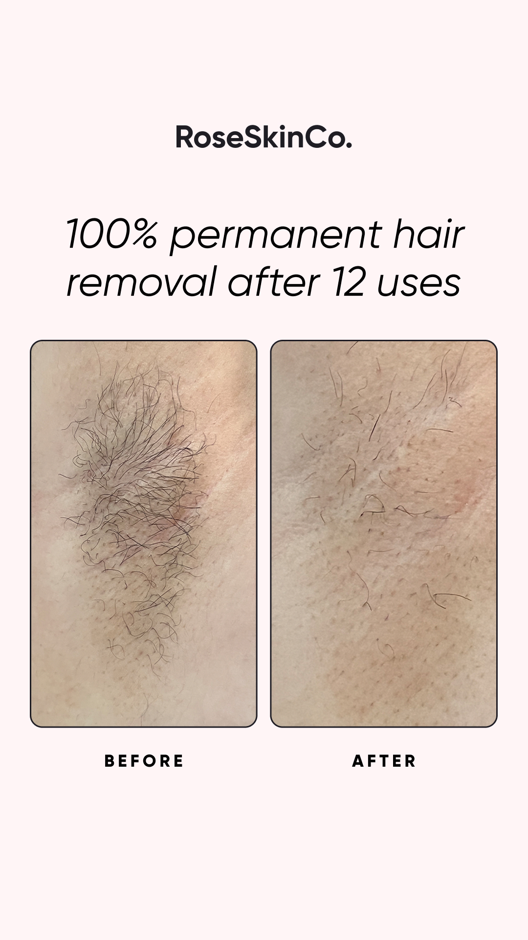 Rose Skin Co Facebook ad