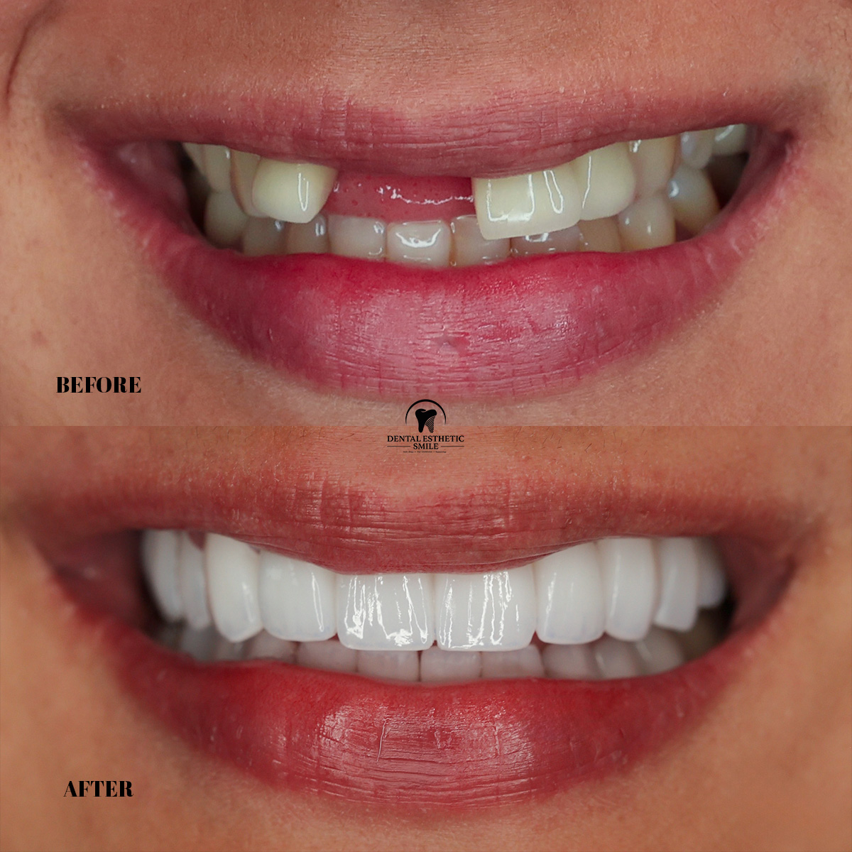 Dental Esthetic Miami Facebook ad: Amazing Smiles by Dental Esthetic Smile!