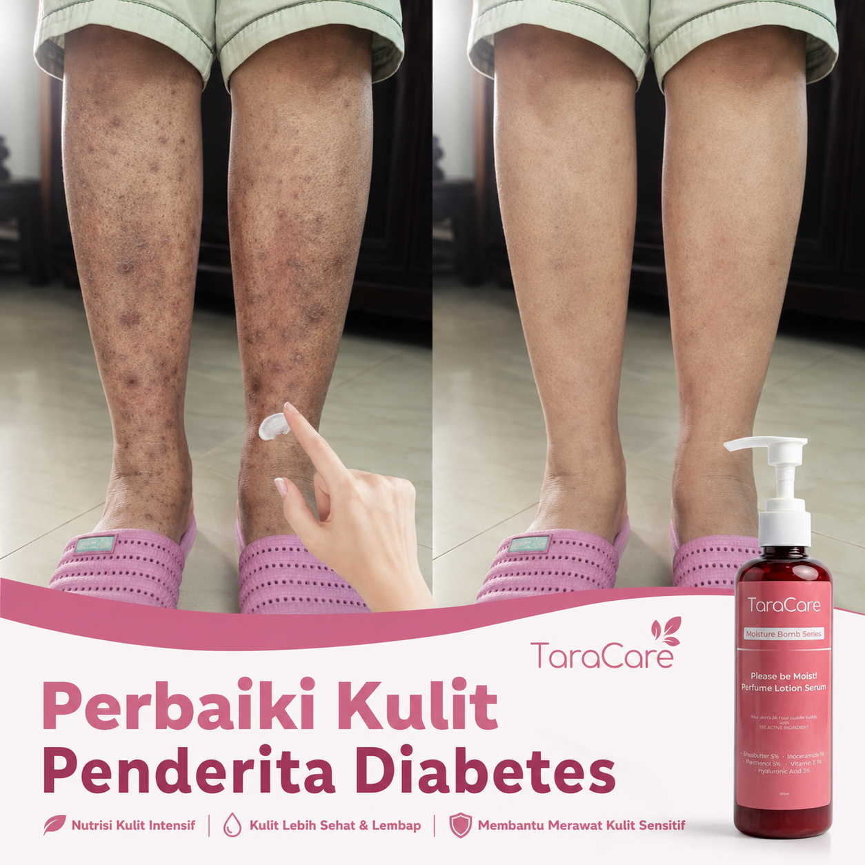 Taracare Indonesia Aesthetic Clinic Facebook ad