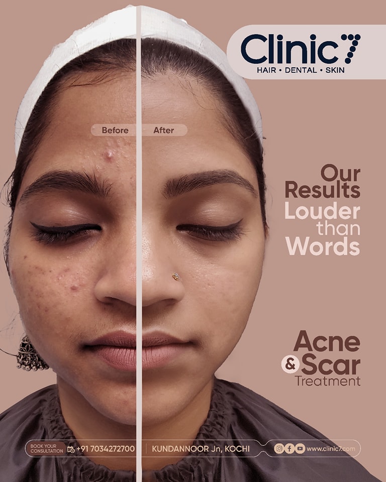 Clinic7 Facebook ad