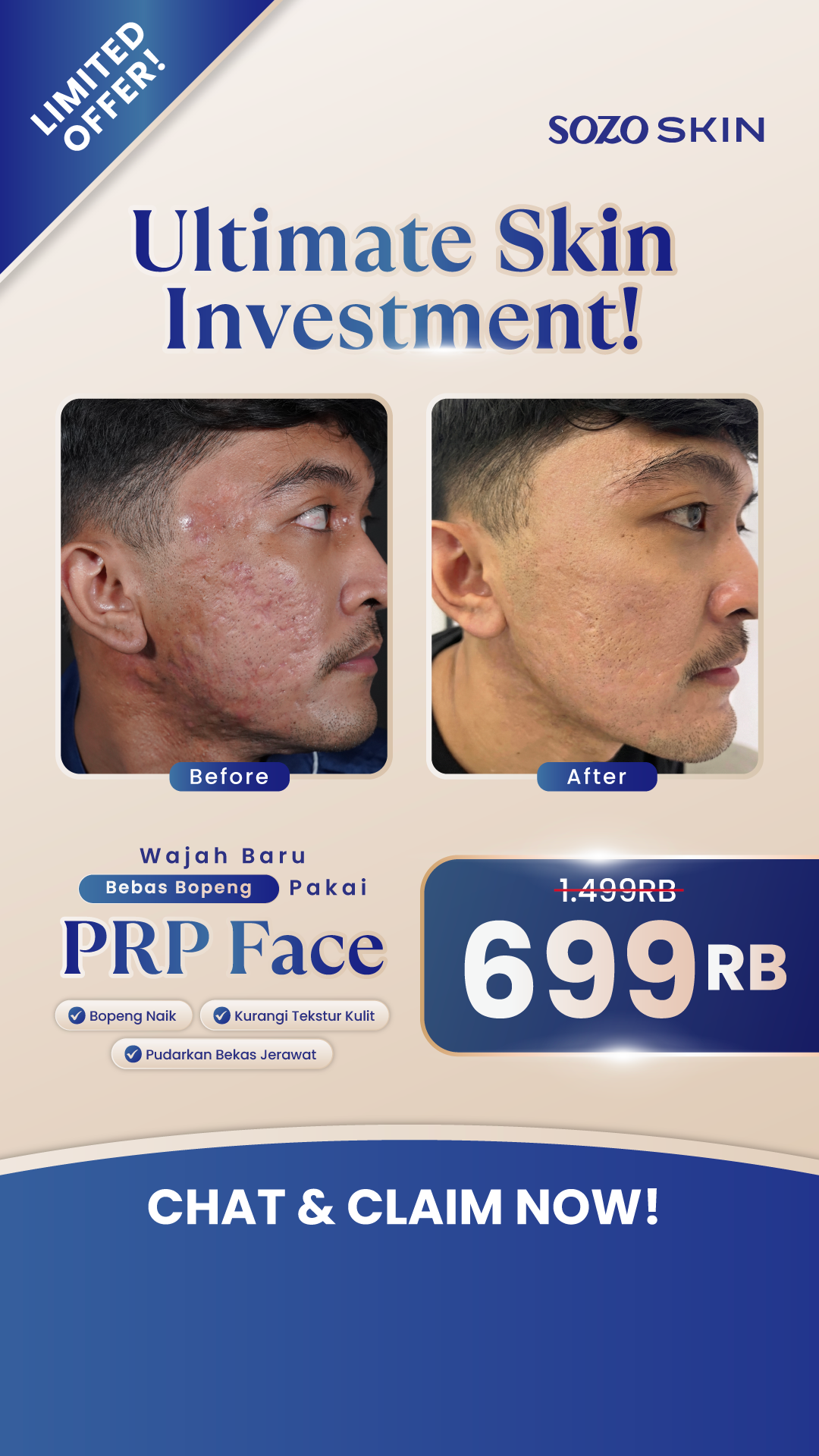 Sozo Skin Clinic Facebook ad