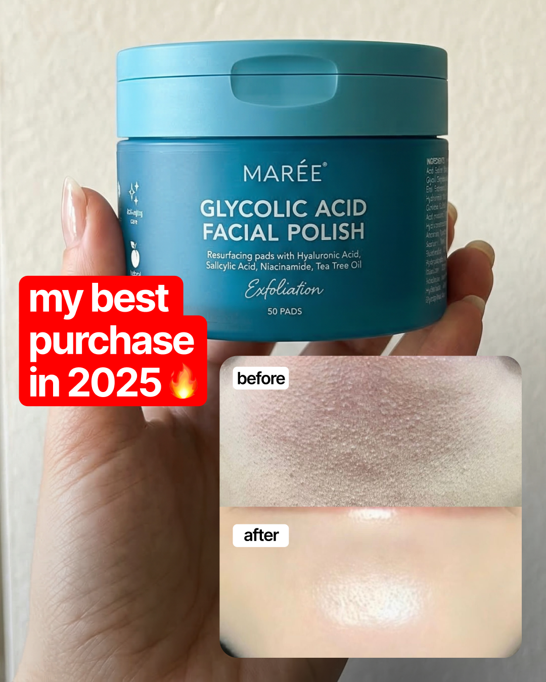 MAREE store Facebook ad: Get yours #1 Amazon Best Seller Now!