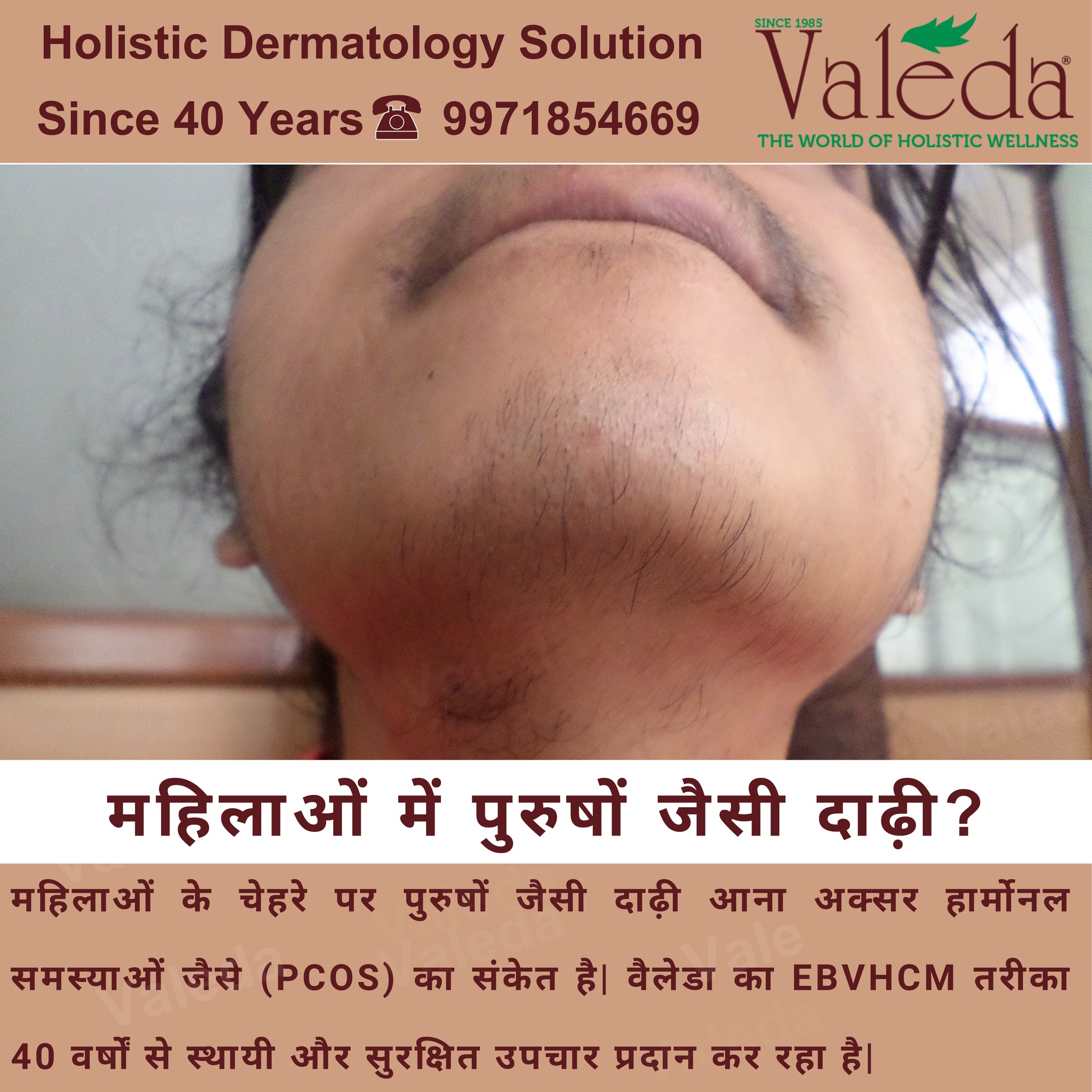 Valeda - The World of Holistic Wellness Facebook ad: महिलाएं अगर दाढ़ी या मर्दाना बालों से परेशान…