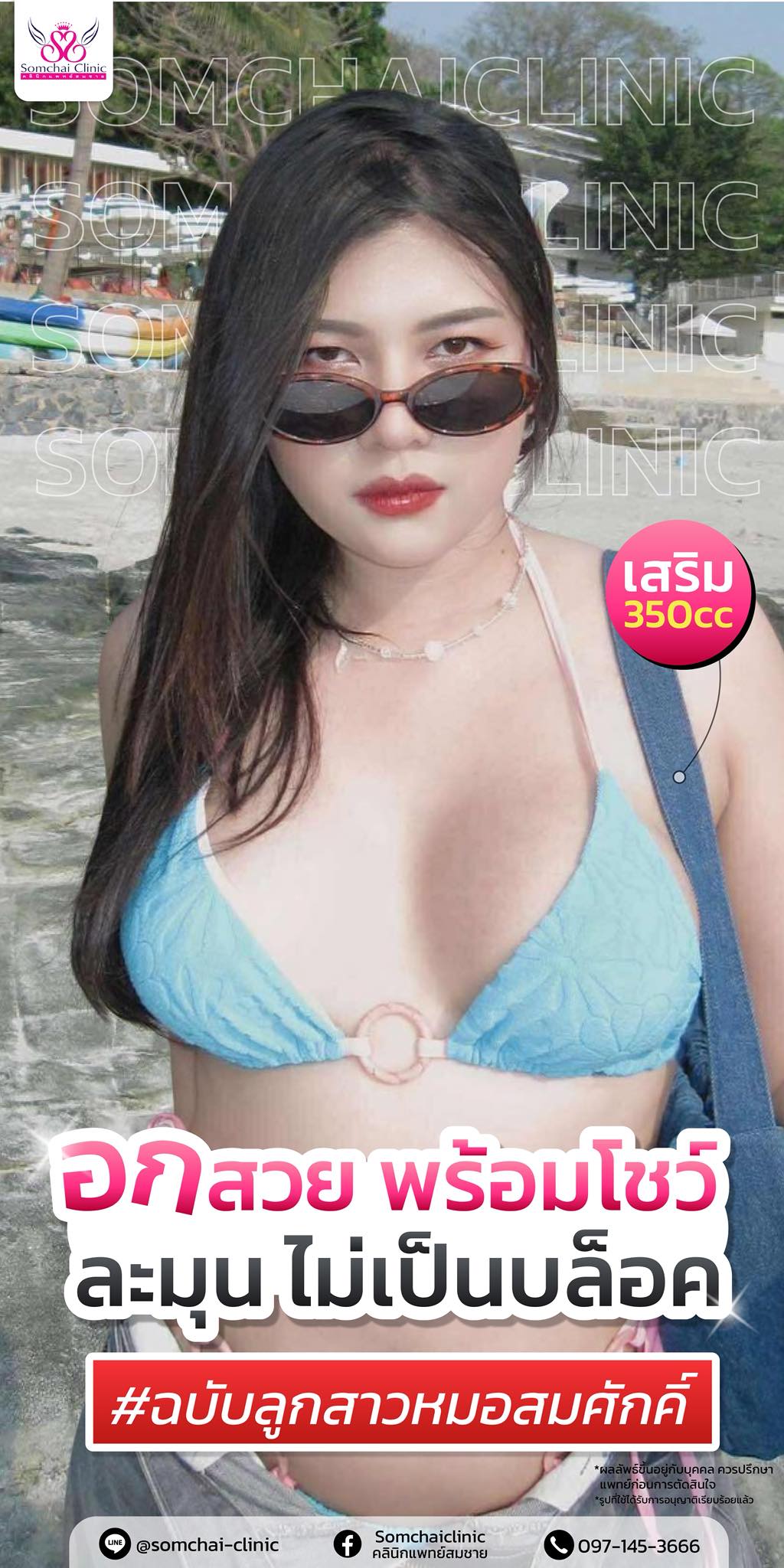 Somchaiclinic คลินิกแพทย์สมชาย Facebook ad
