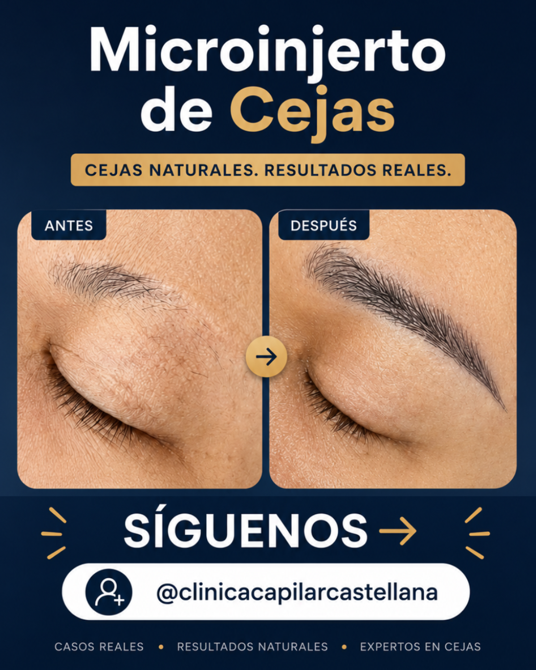 Clinica Capilar Castellana Facebook ad: En Clínica Capilar Castellana mostramos resultados reales…
