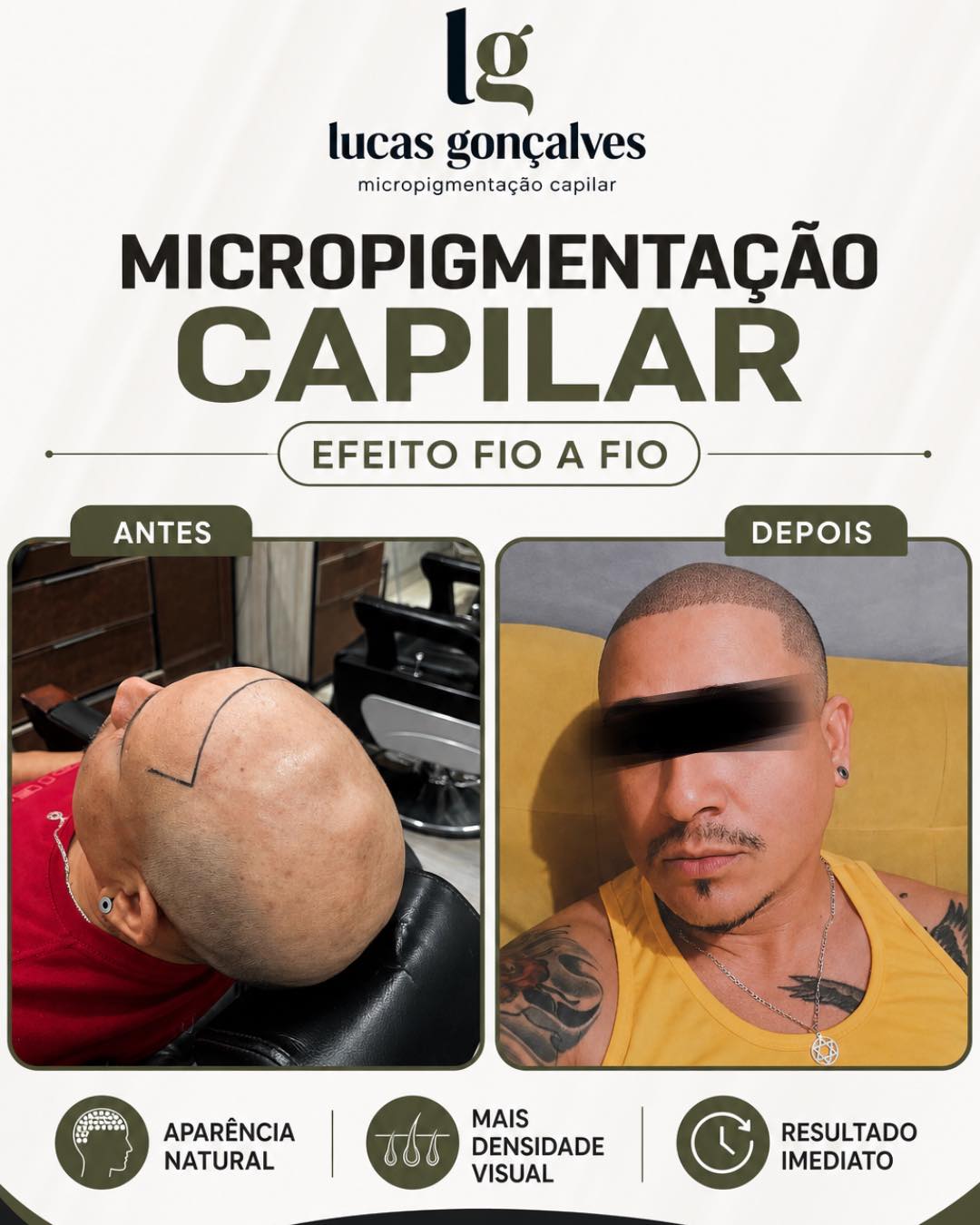 Lucas microcapilar Facebook ad: Esse aqui é o resultado da micropigmentação capilar