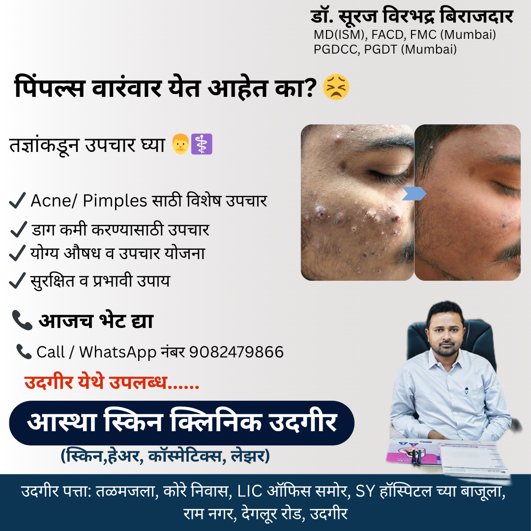 Astha Skin Clinic at Dr. Suraj Facebook ad: पिंपल्समुळे चेहरा खराब दिसतोय?