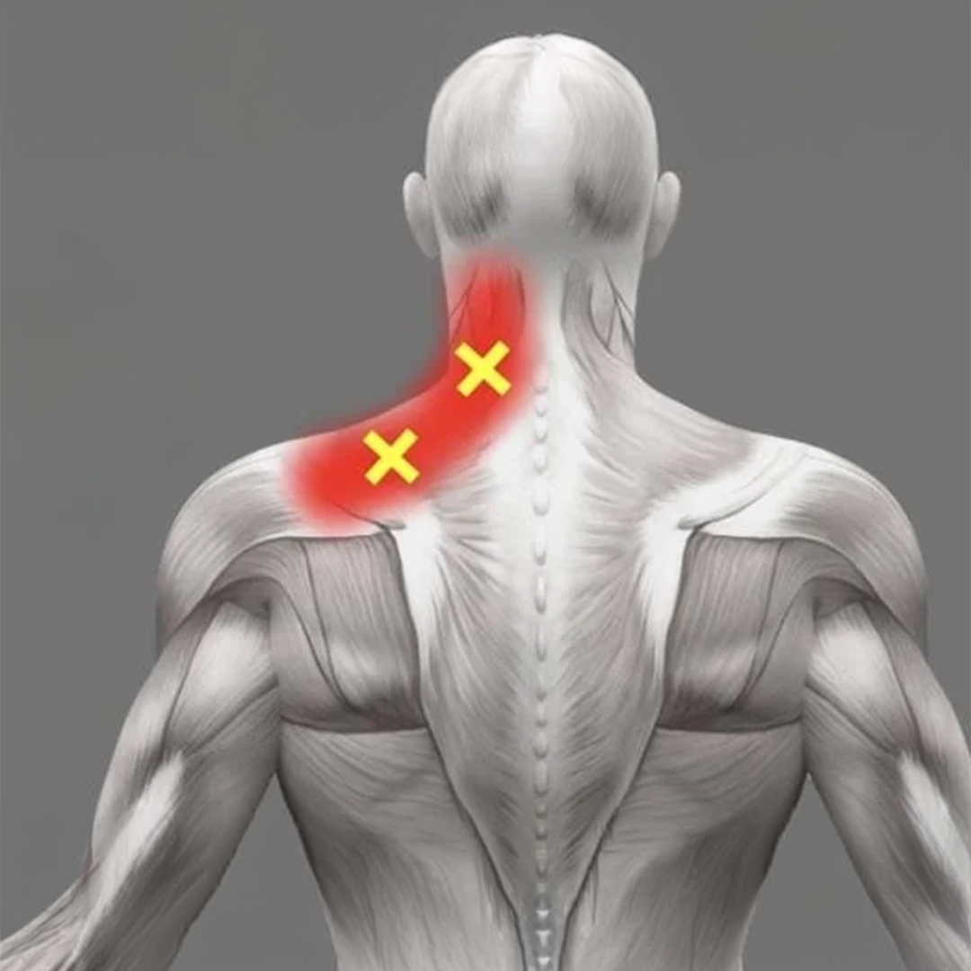 Susan Collins - The Neck & Shoulder Pain Community Facebook ad