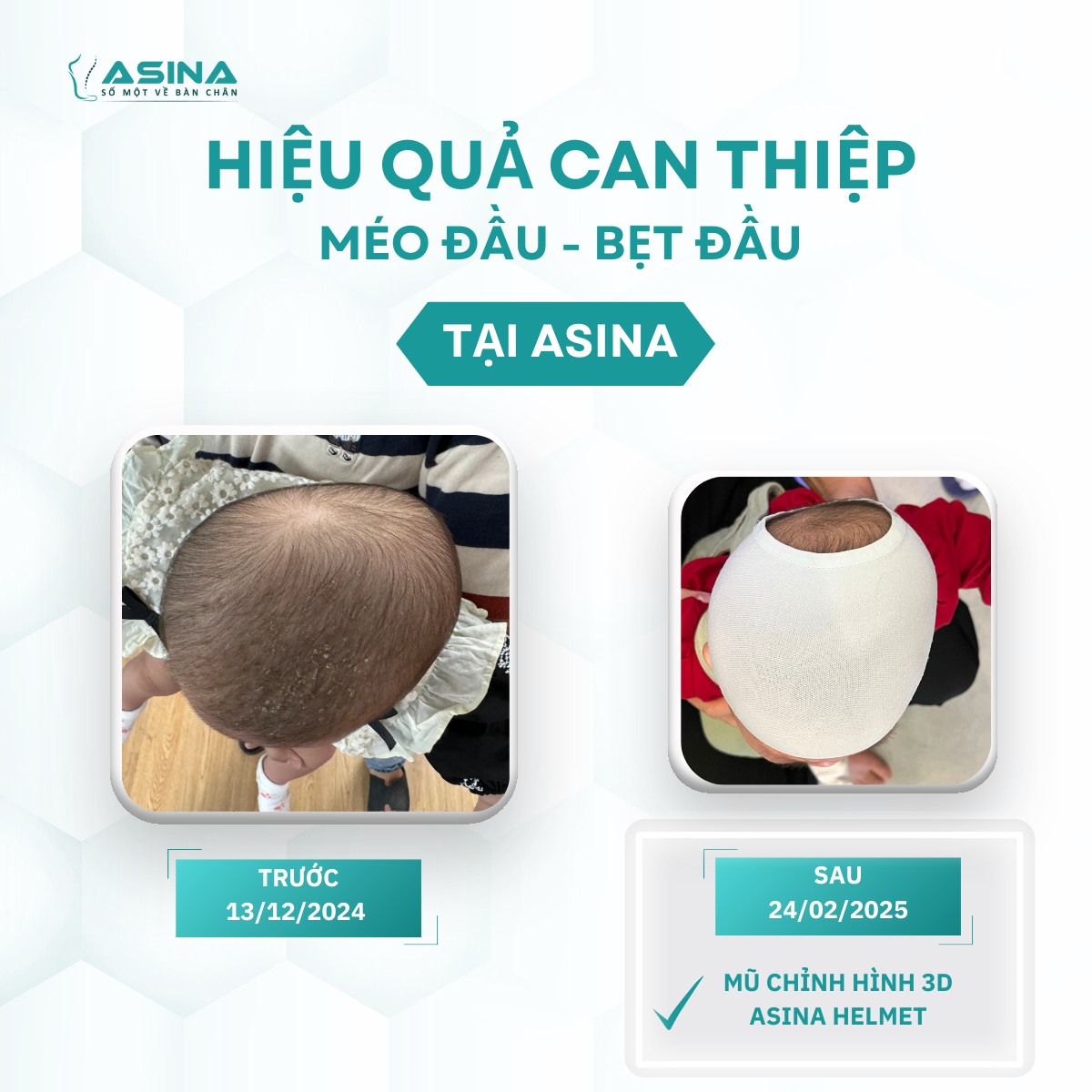 Trung Tâm Cân Bằng Cấu Trúc ASINA Facebook ad: ĐẦU TRÒN ĐẸP - HÀNH TRÌNH THAY ĐỔI…