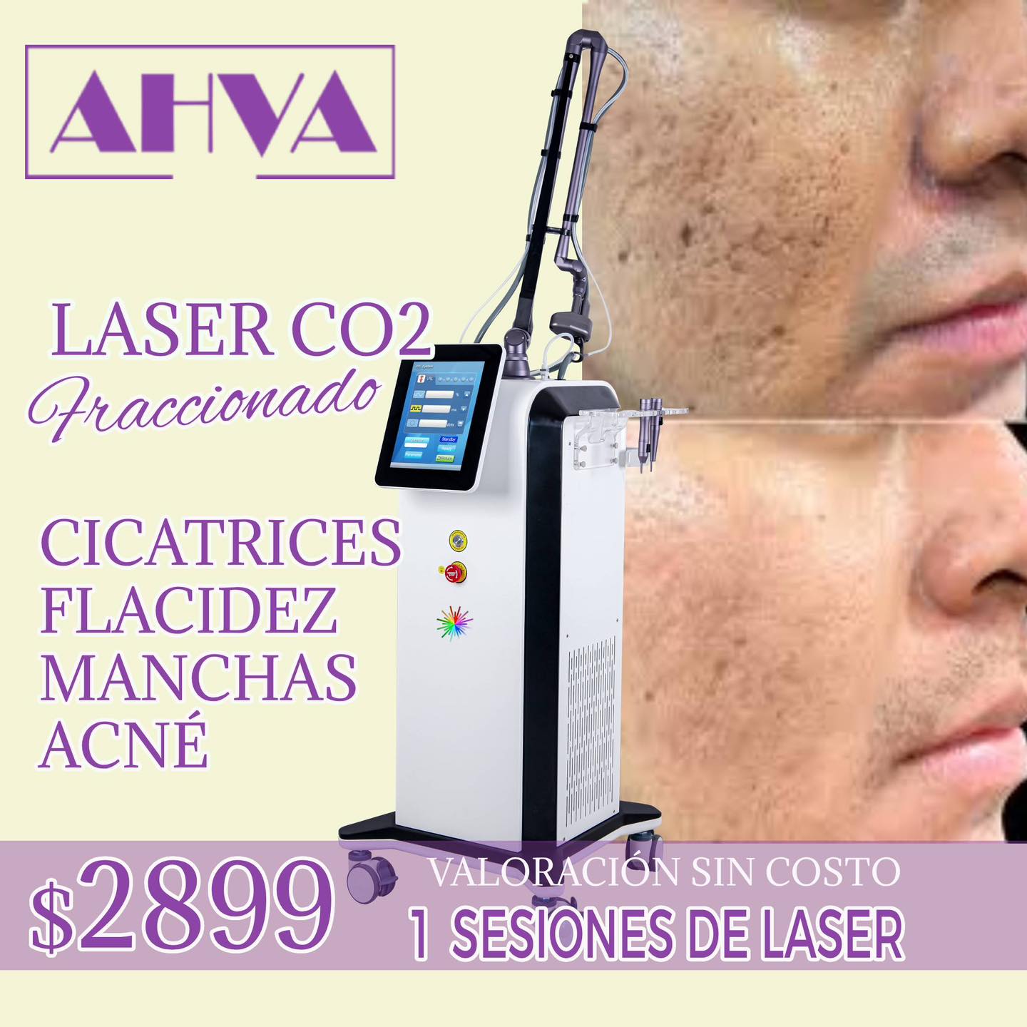 AHVA SPA Facebook ad: TRATAMIENTOS LÁSER Y REGENERATIVOS
