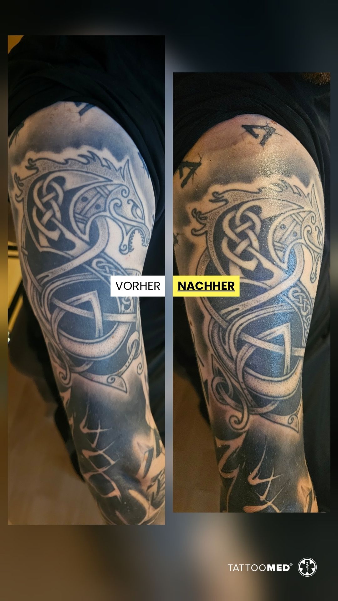 TattooMed Facebook ad