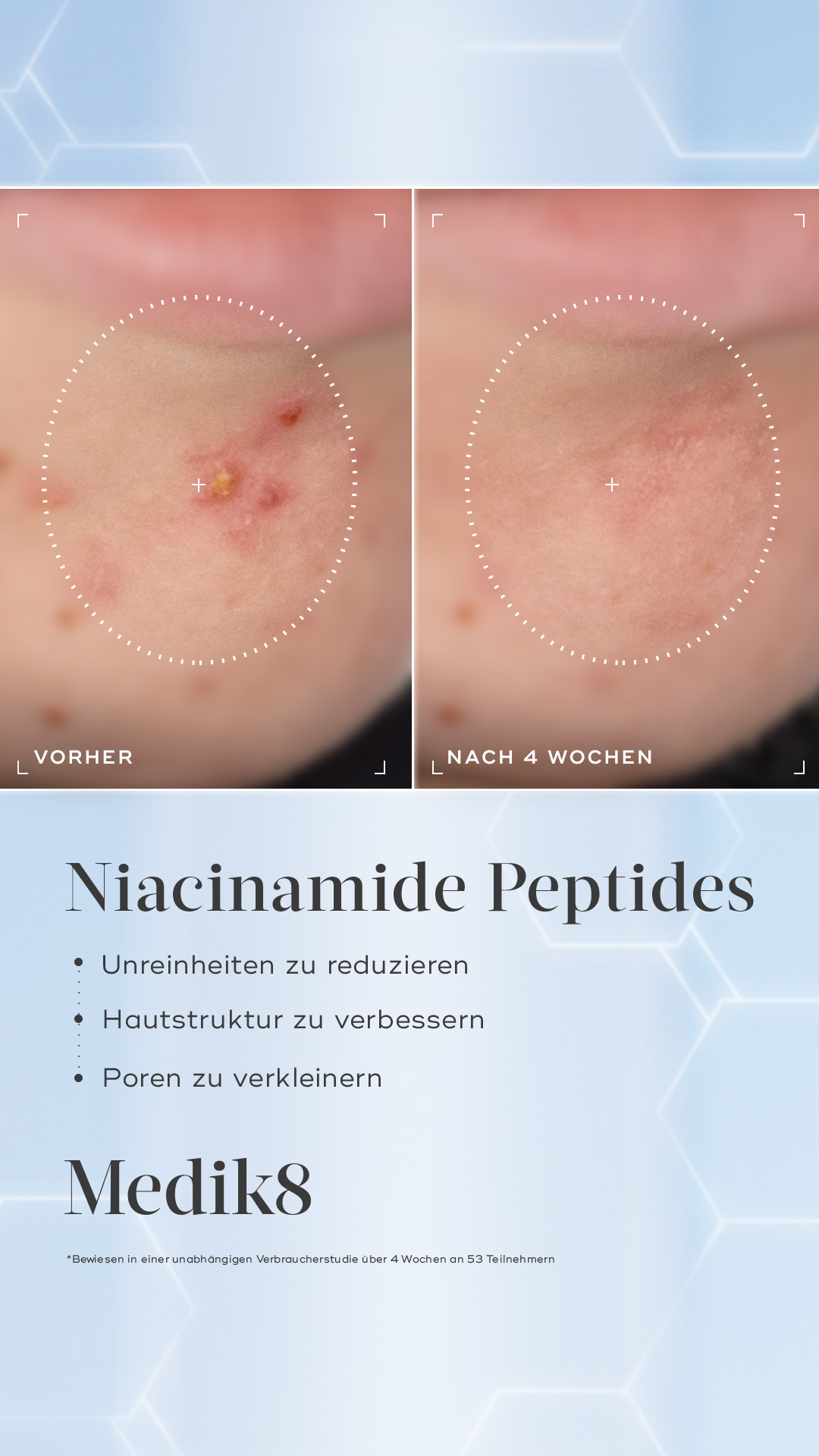 Medik8 Facebook ad